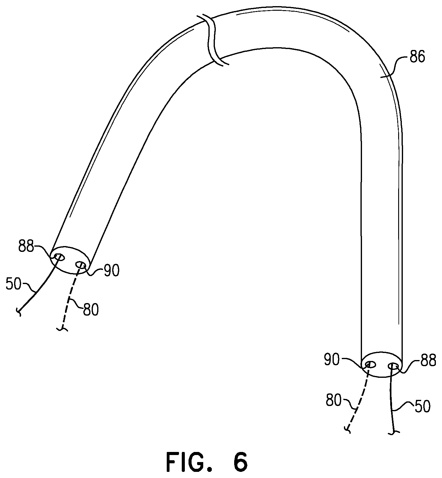 Patent US12310845 Figure 6 – Docking elements