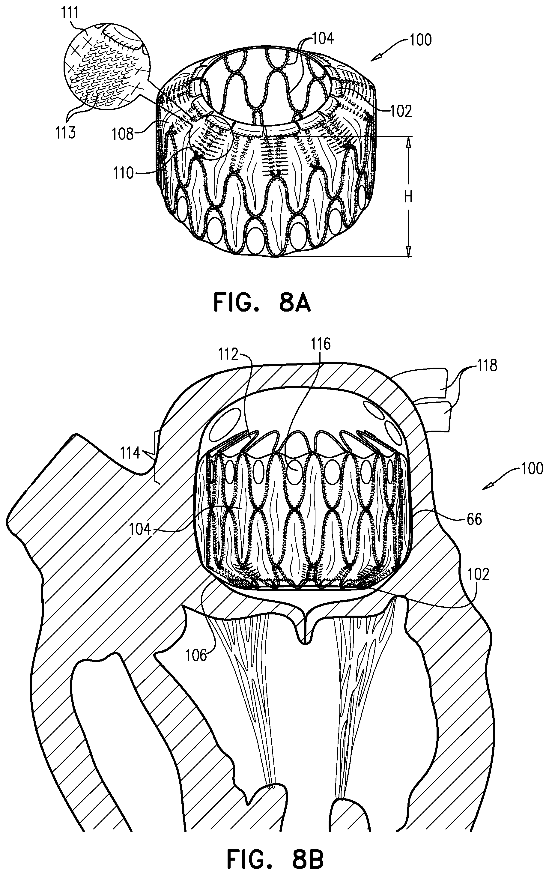 Patent US12310845 Figure 8 – Docking elements