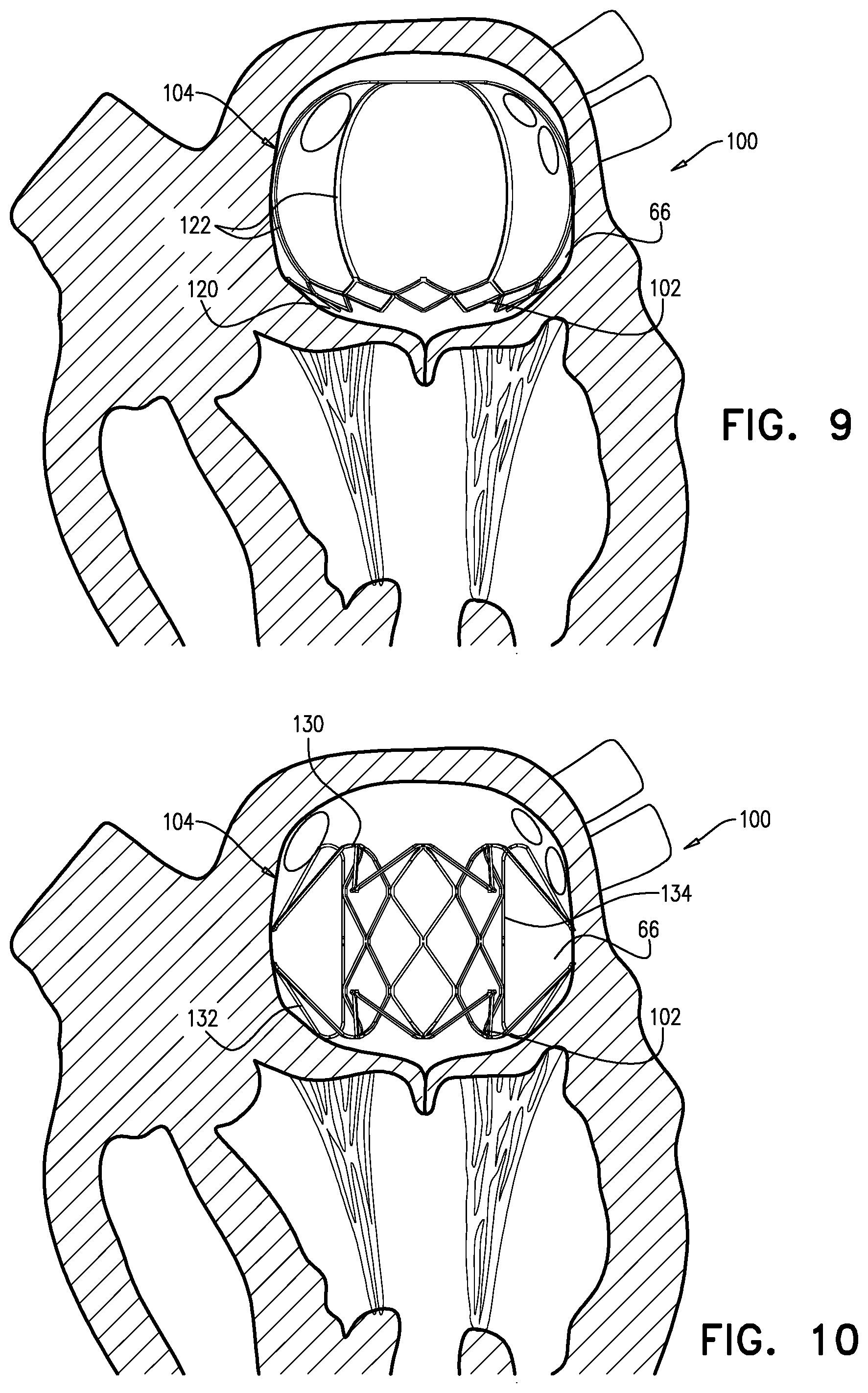 Patent US12310845 Figure 9 – Docking elements