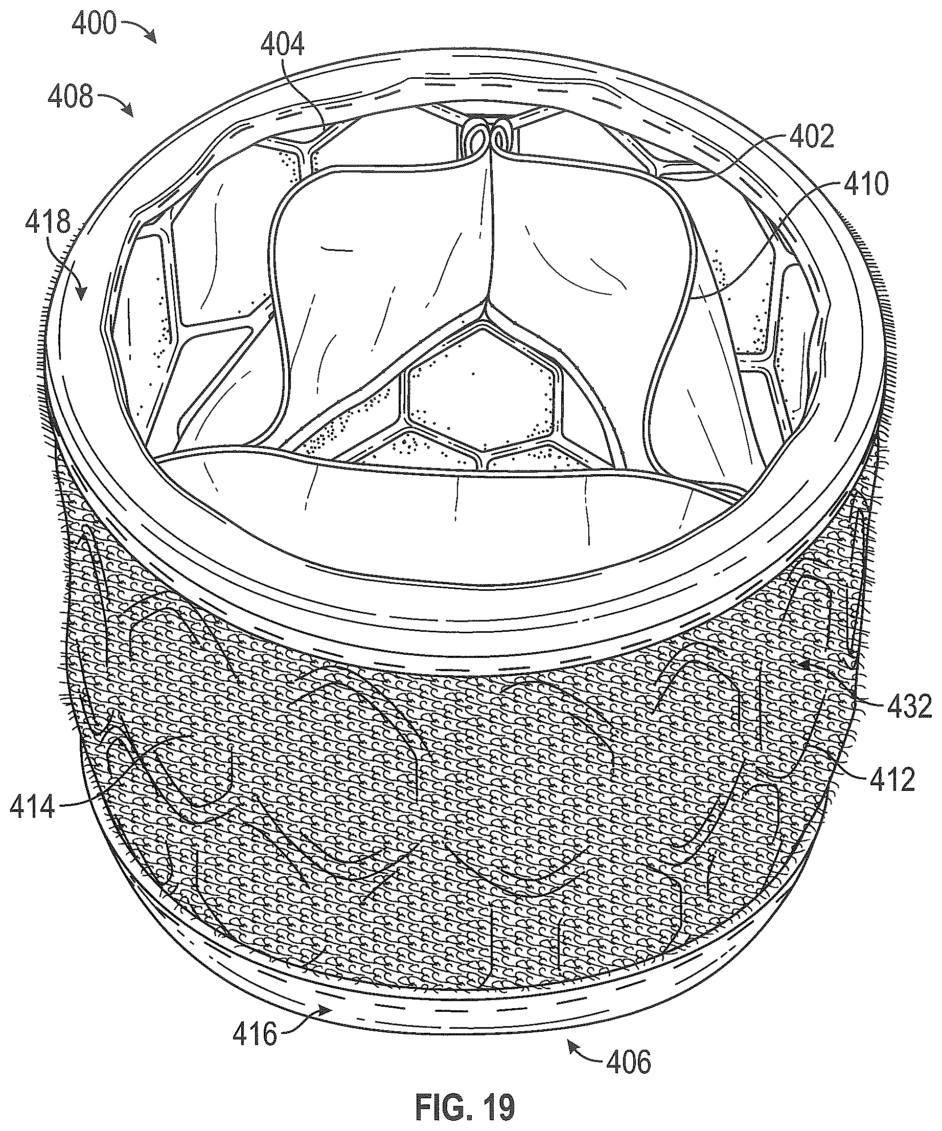 Patent US12310846 Figure 14 – Covered prosthetic heart valve