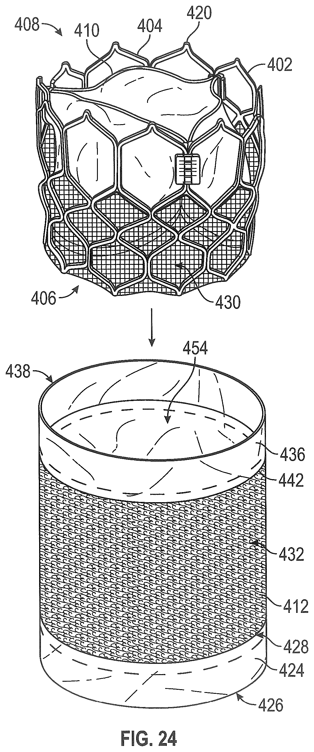 Patent US12310846 Figure 17 – Covered prosthetic heart valve
