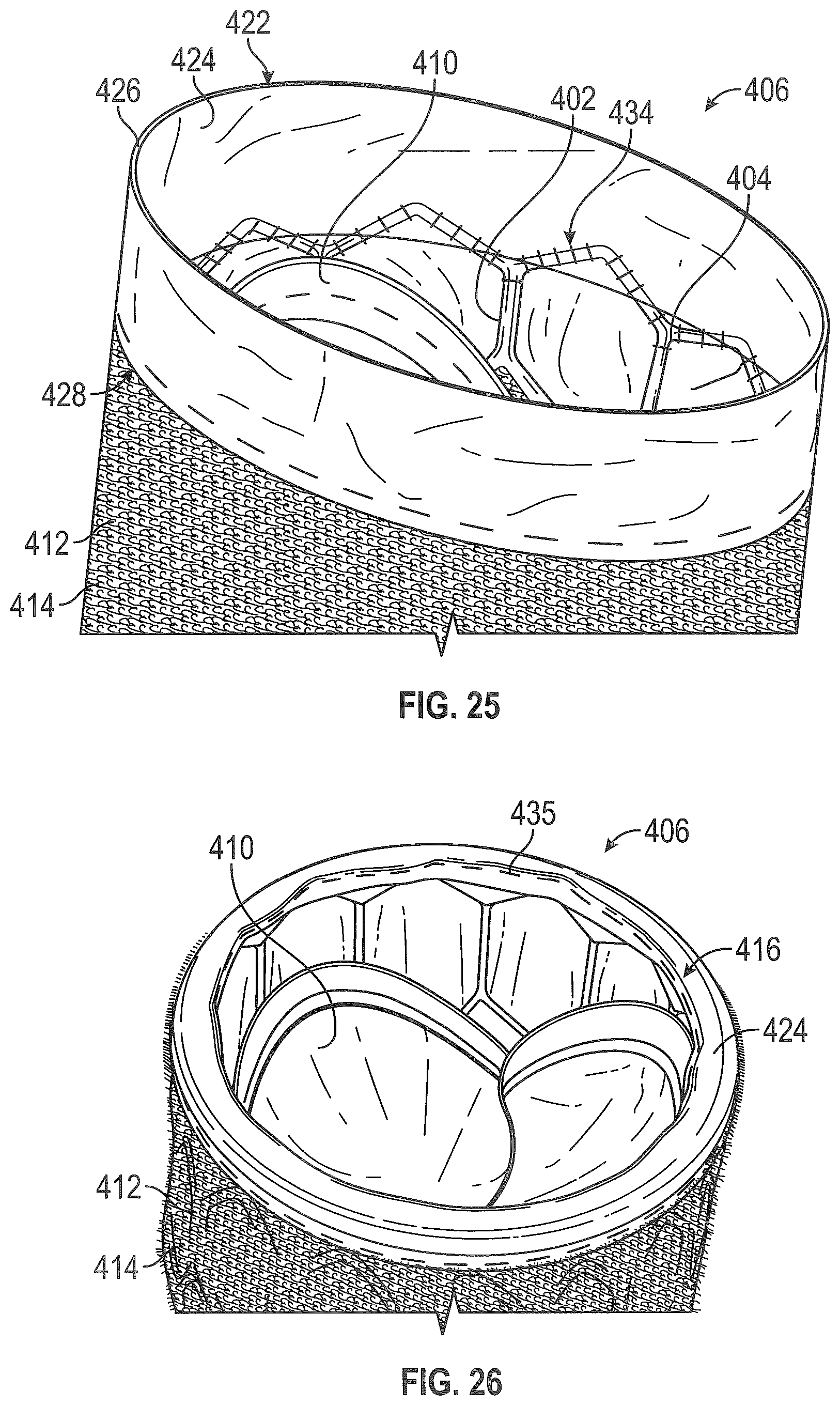 Patent US12310846 Figure 18 – Covered prosthetic heart valve