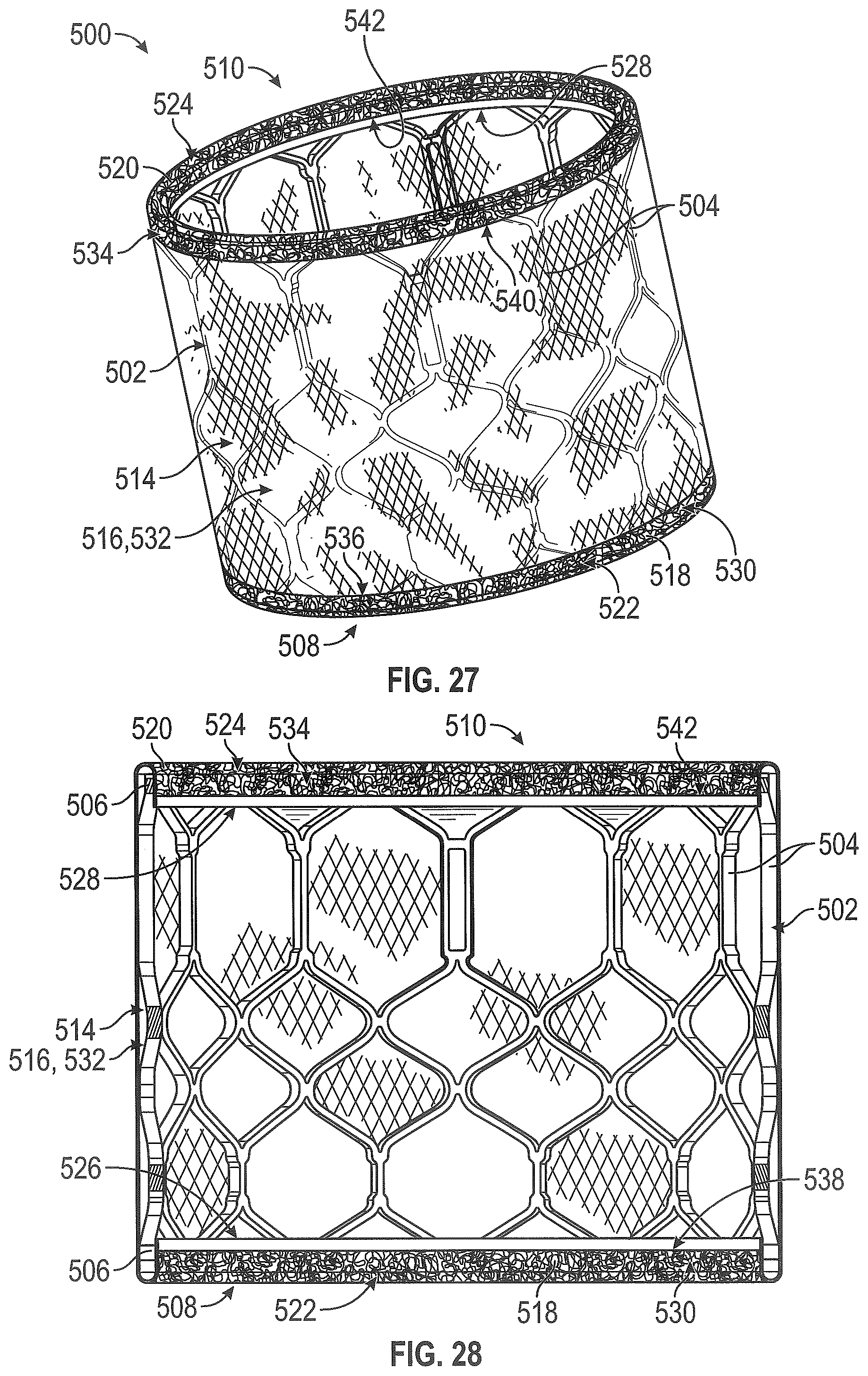 Patent US12310846 Figure 19 – Covered prosthetic heart valve