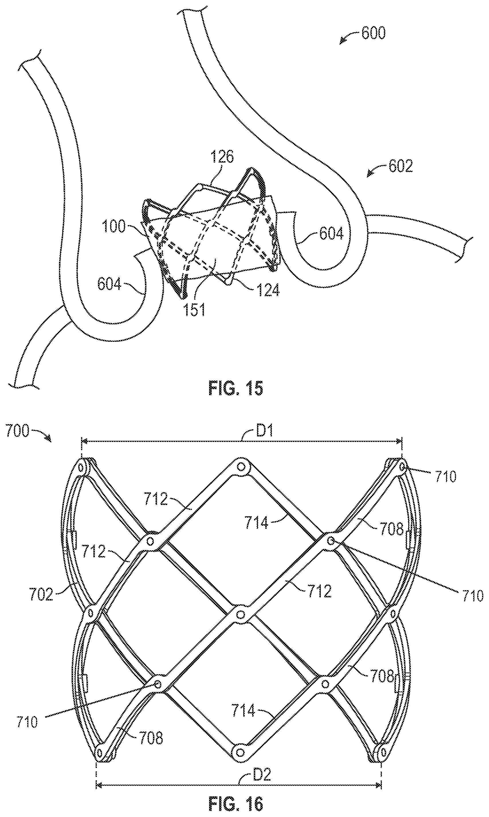 Patent US12310847 Figure 12 – Prosthetic heart valve having non-cylindrical frame