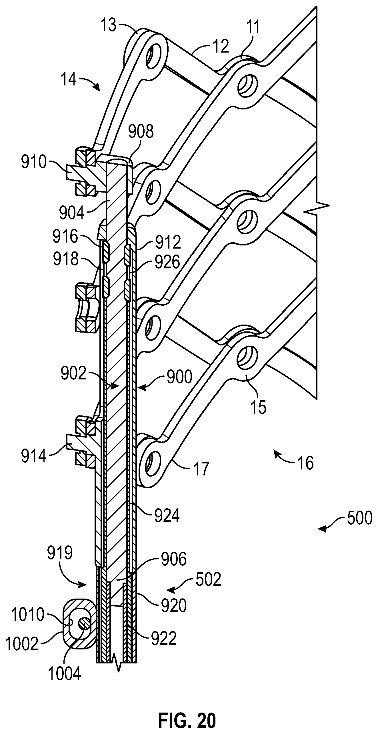 Patent US12310847 Figure 17 – Prosthetic heart valve having non-cylindrical frame