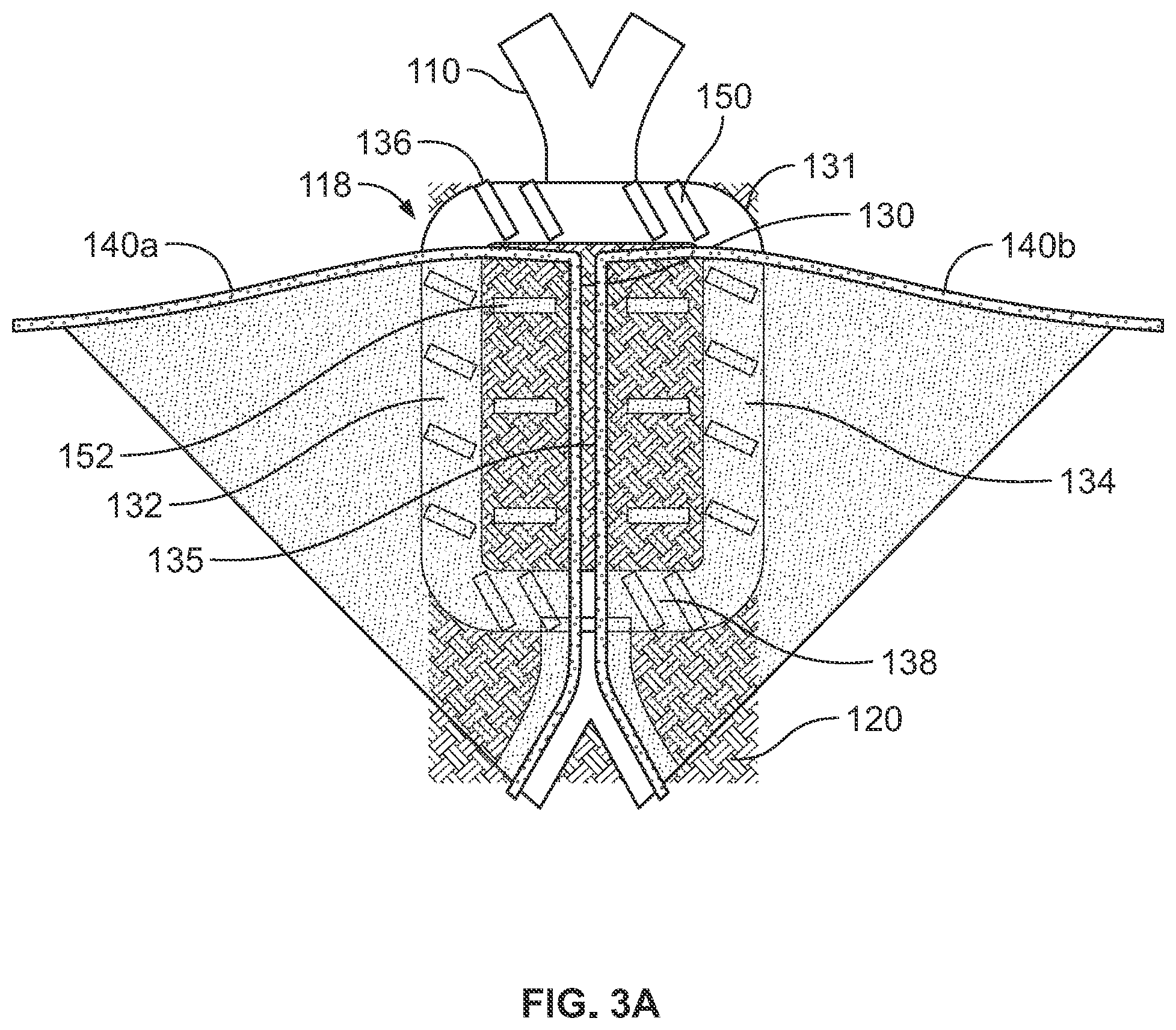 Patent US12310848 Figure 3 – Leaflet attachment to prosthetic heart valve