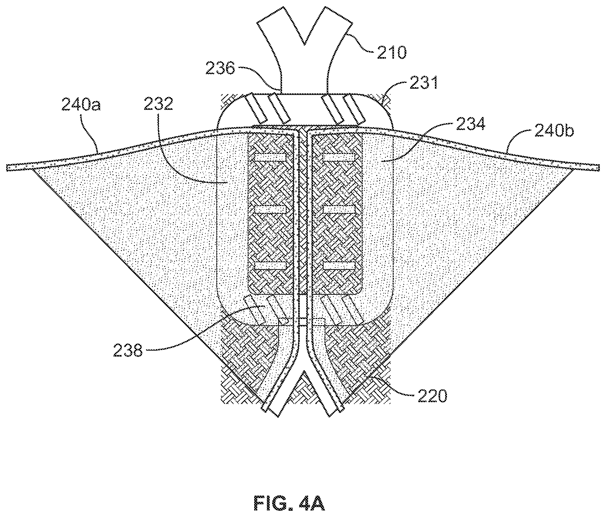 Patent US12310848 Figure 5 – Leaflet attachment to prosthetic heart valve