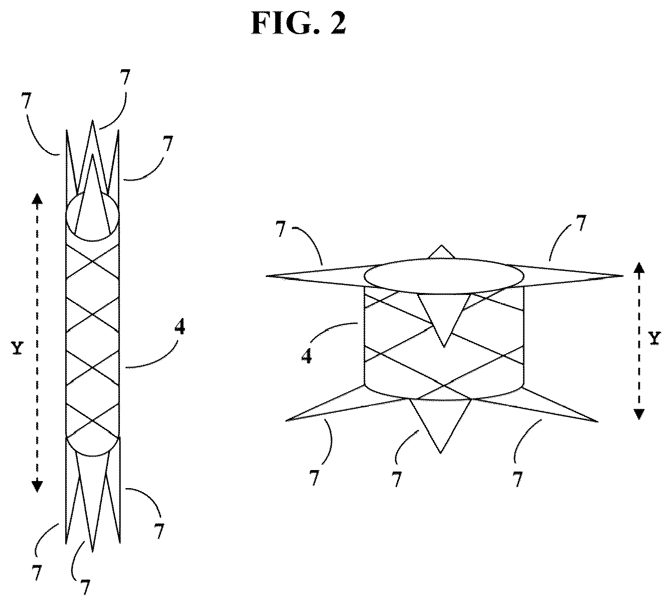 Patent US12310849 Figure 2 – Valve prosthesis