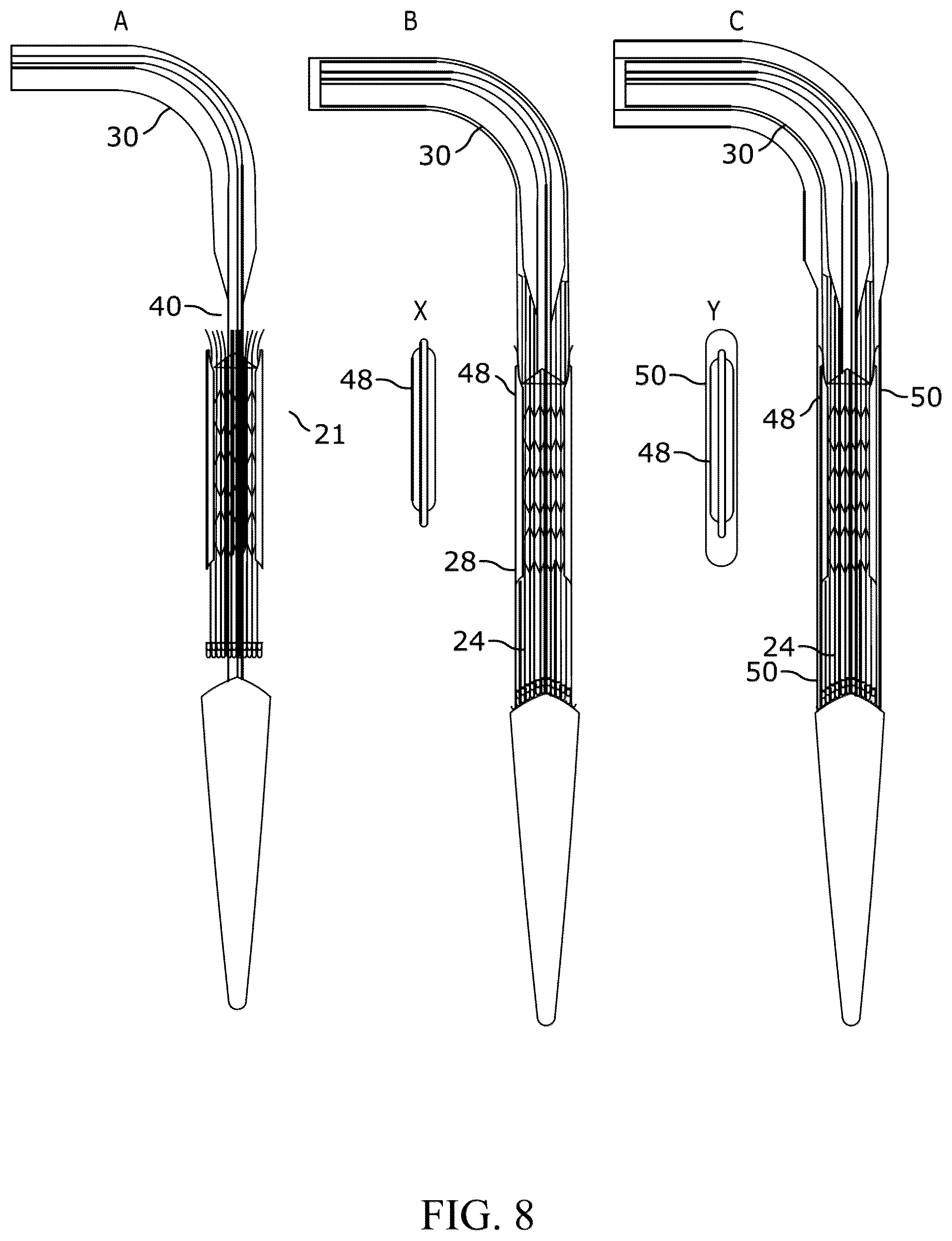 Patent US12310849 Figure 8 – Valve prosthesis