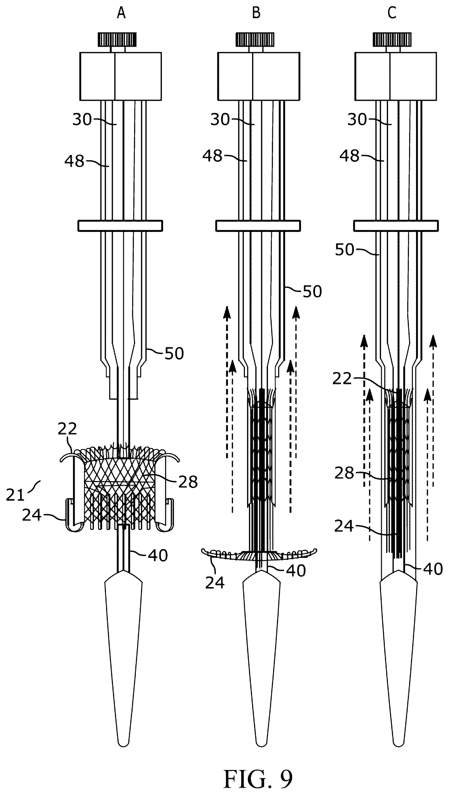 Patent US12310849 Figure 9 – Valve prosthesis
