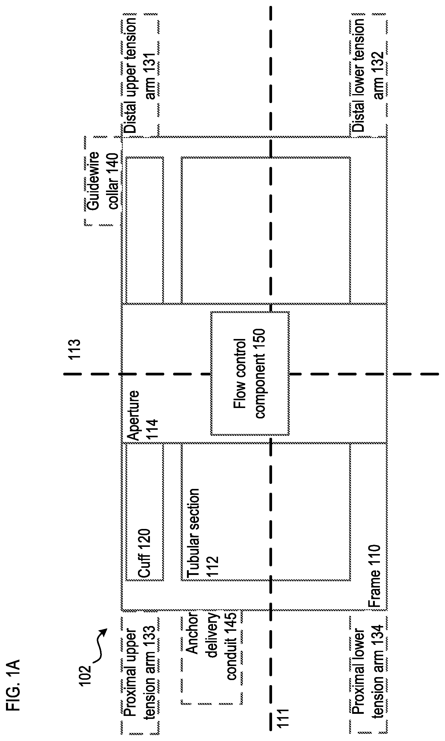Patent US12310850 Figure 1 – Transcatheter deliverable prosthetic heart valves and methods of delivery