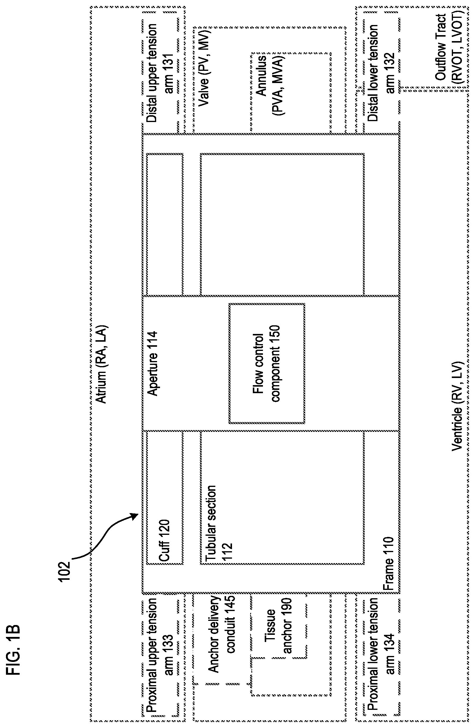 Patent US12310850 Figure 2 – Transcatheter deliverable prosthetic heart valves and methods of delivery