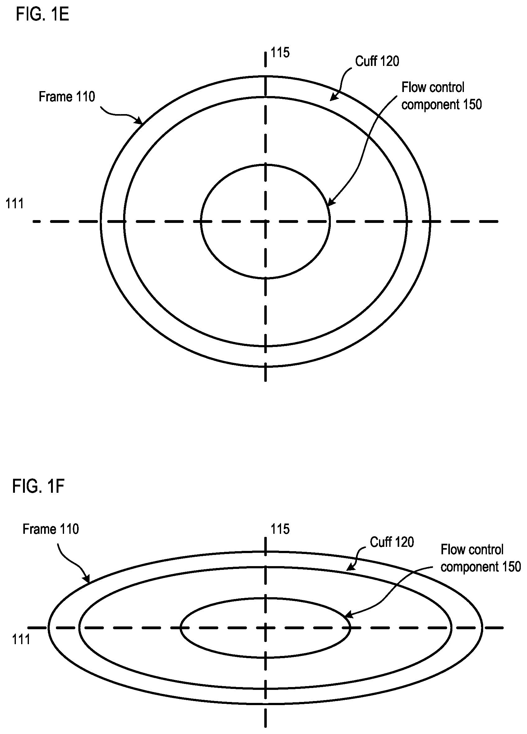Patent US12310850 Figure 4 – Transcatheter deliverable prosthetic heart valves and methods of delivery