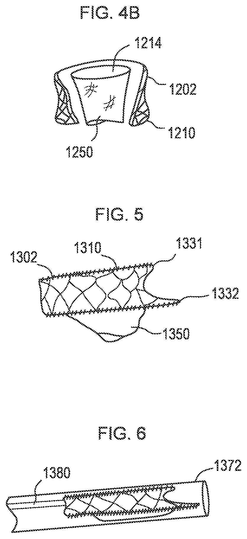 Patent US12310850 Figure 6 – Transcatheter deliverable prosthetic heart valves and methods of delivery