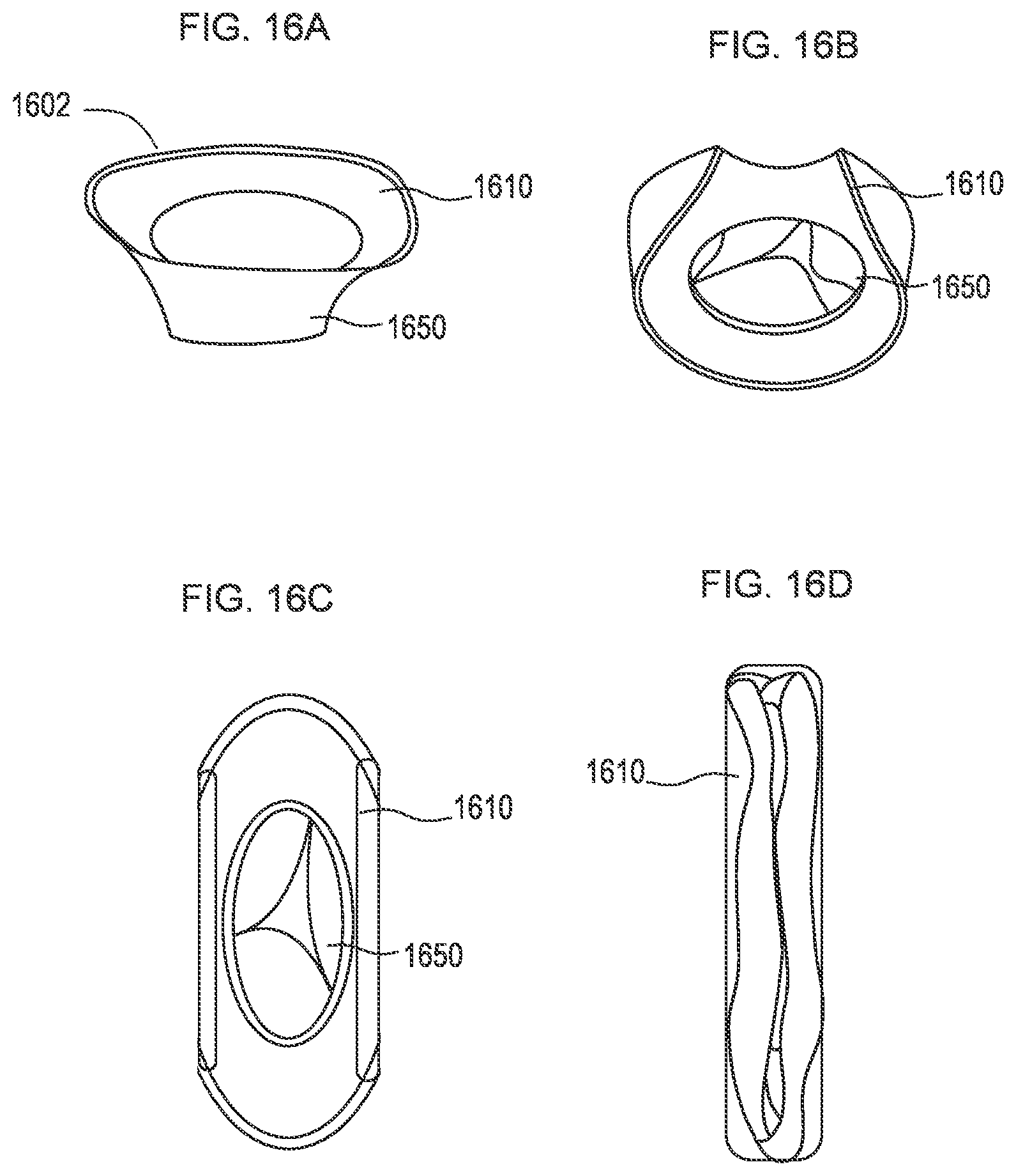 Patent US12310850 Figure 10 – Transcatheter deliverable prosthetic heart valves and methods of delivery
