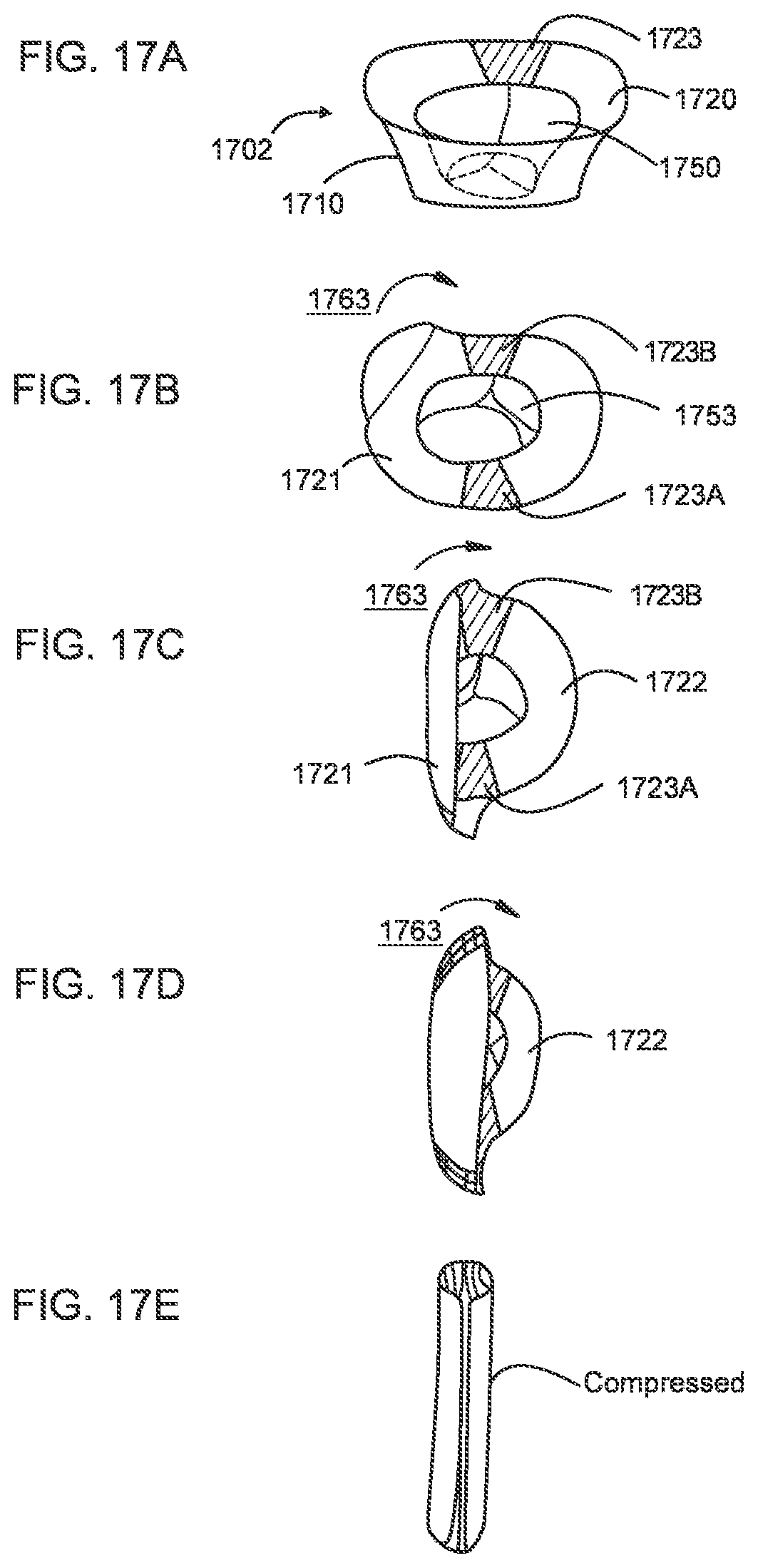 Patent US12310850 Figure 11 – Transcatheter deliverable prosthetic heart valves and methods of delivery