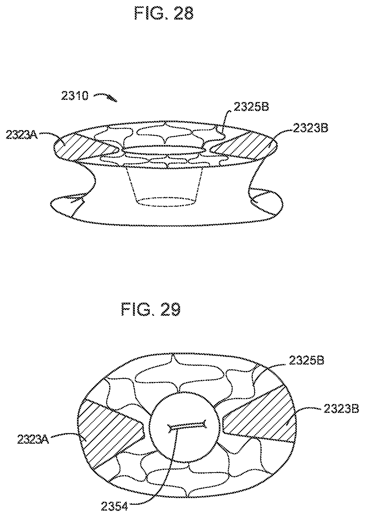 Patent US12310850 Figure 16 – Transcatheter deliverable prosthetic heart valves and methods of delivery
