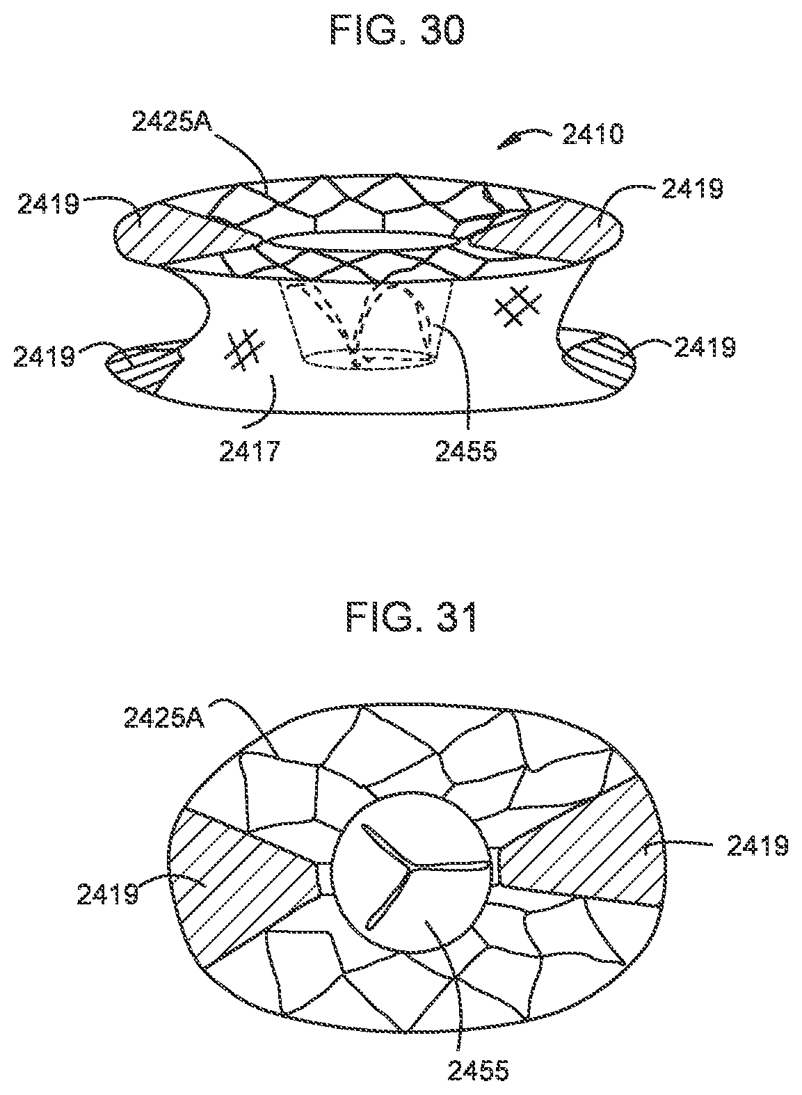 Patent US12310850 Figure 17 – Transcatheter deliverable prosthetic heart valves and methods of delivery
