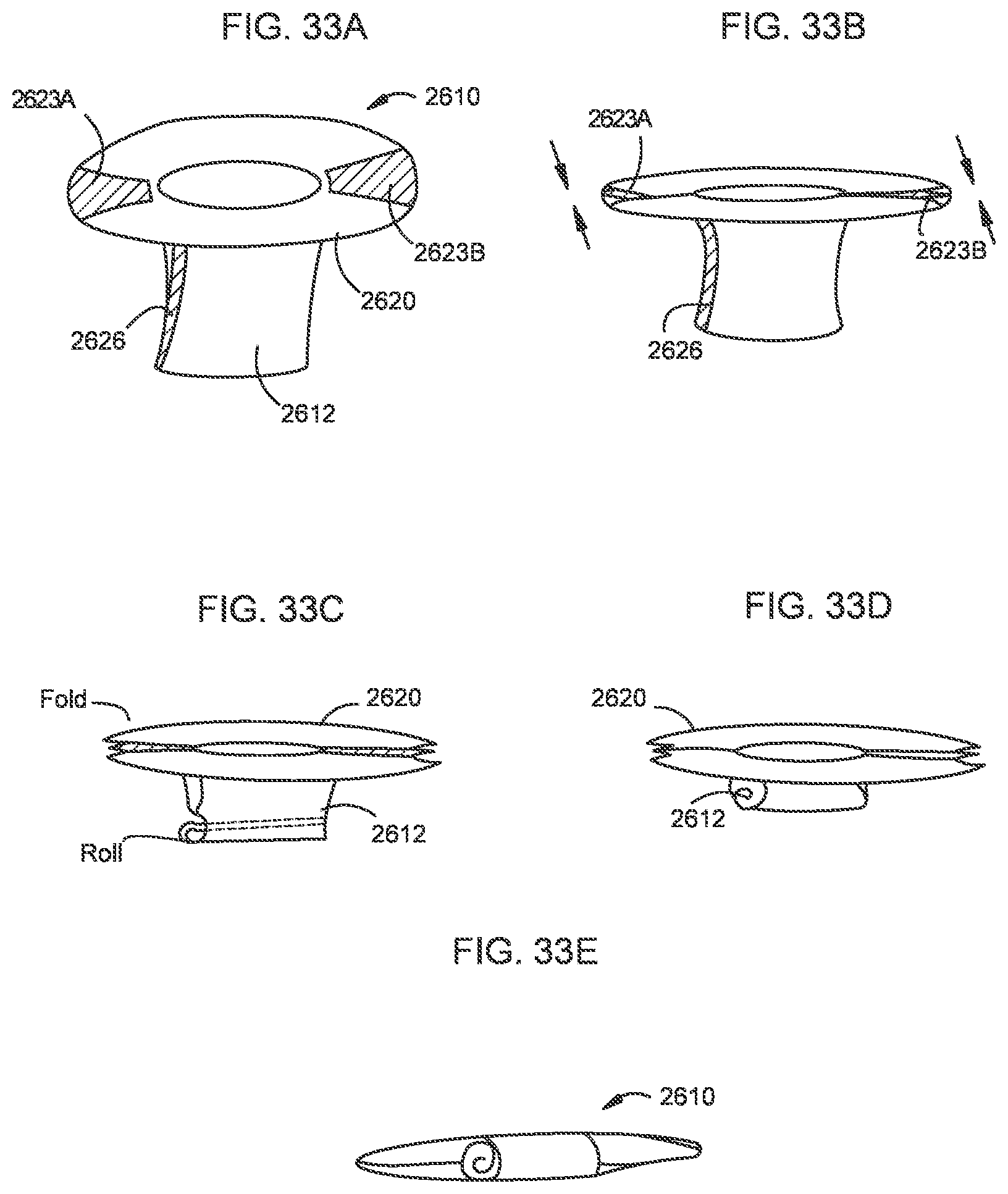 Patent US12310850 Figure 19 – Transcatheter deliverable prosthetic heart valves and methods of delivery