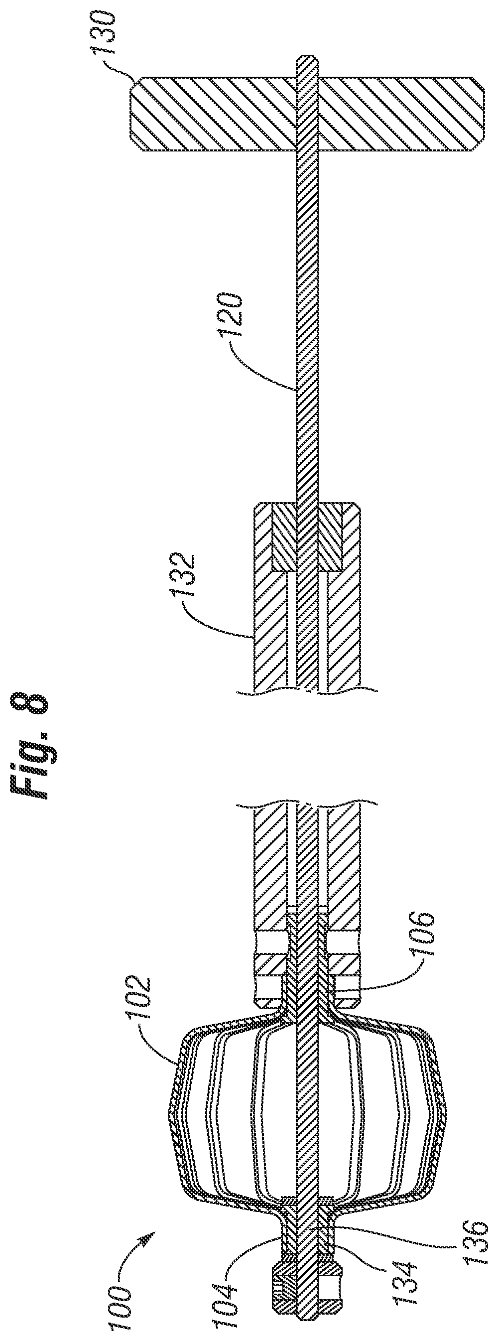 Patent US12310851 Figure 3 – Method for deploying a prosthetic heart valve