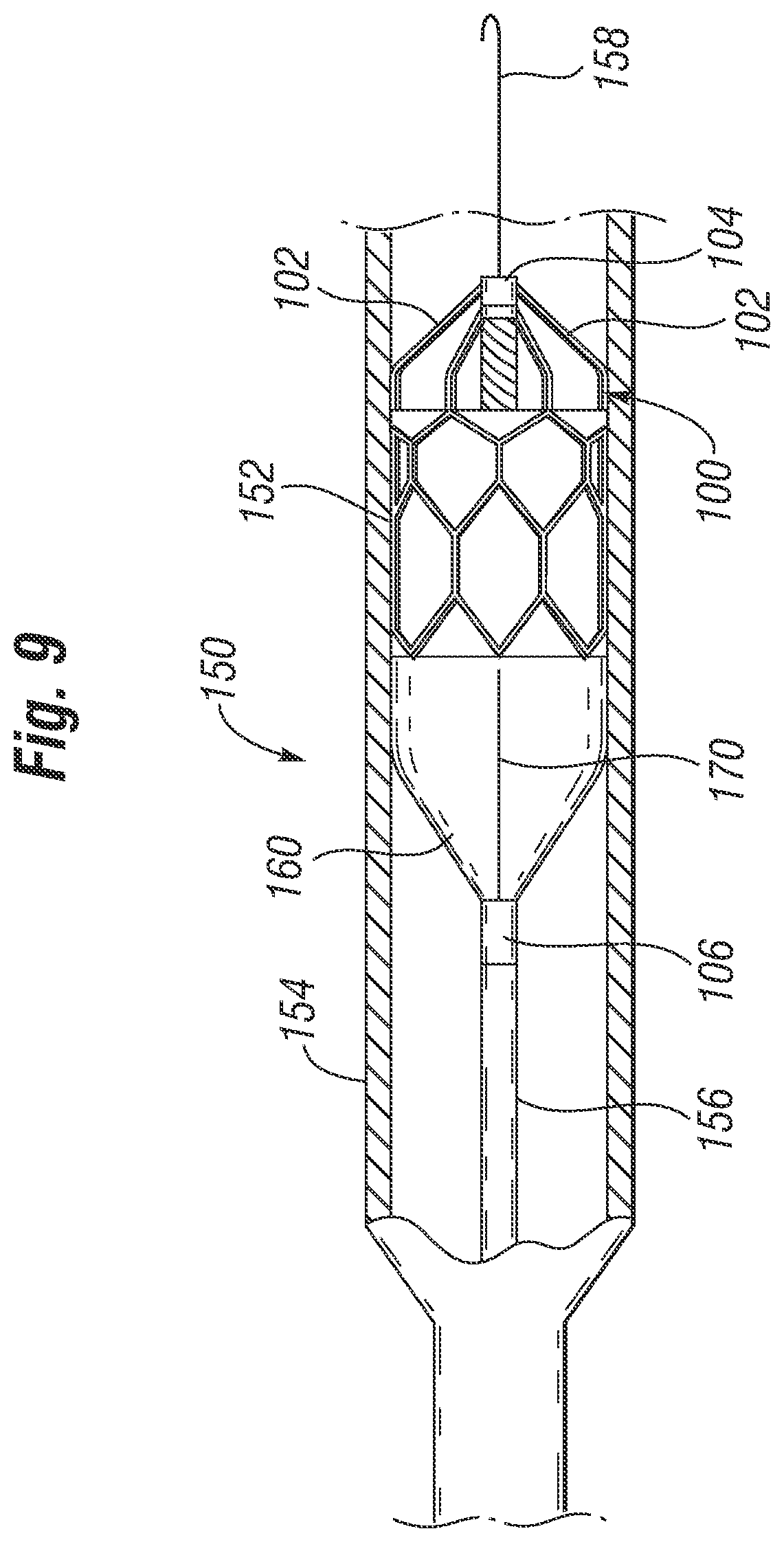 Patent US12310851 Figure 4 – Method for deploying a prosthetic heart valve