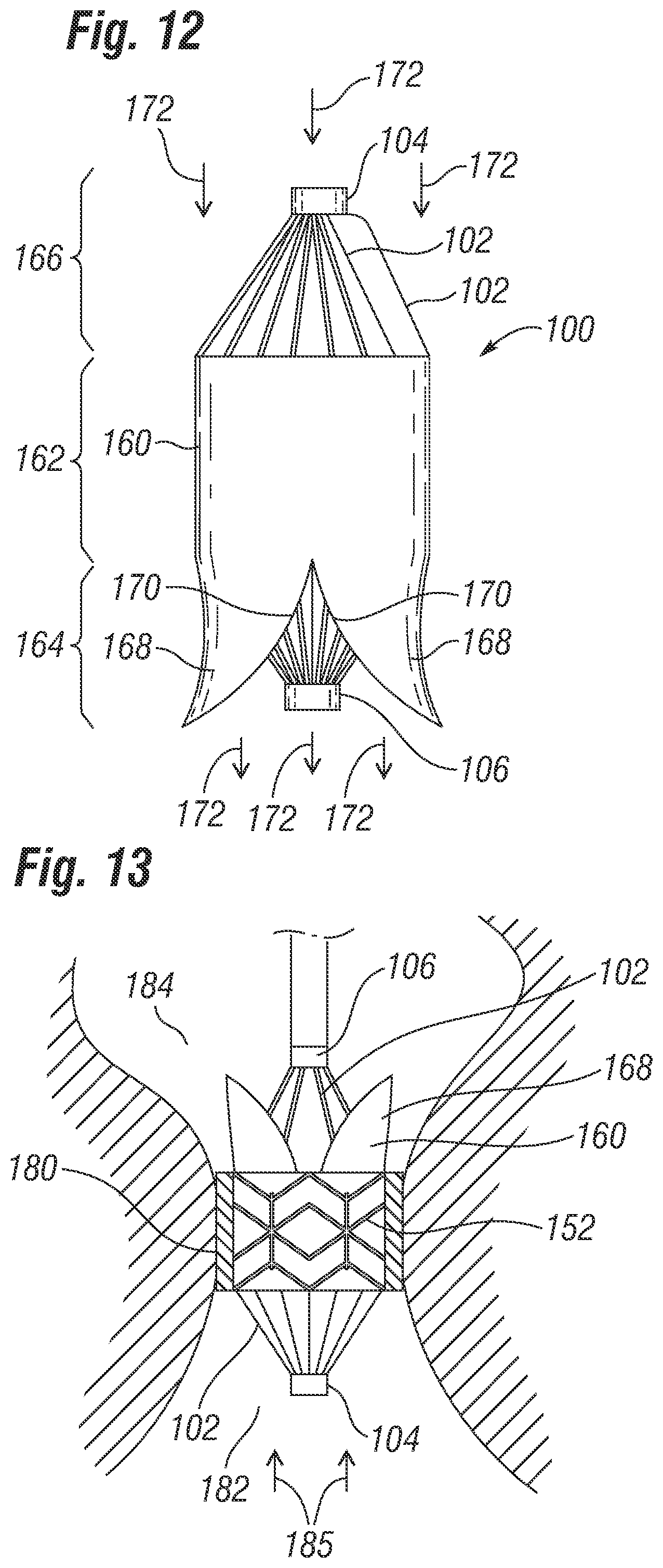 Patent US12310851 Figure 7 – Method for deploying a prosthetic heart valve