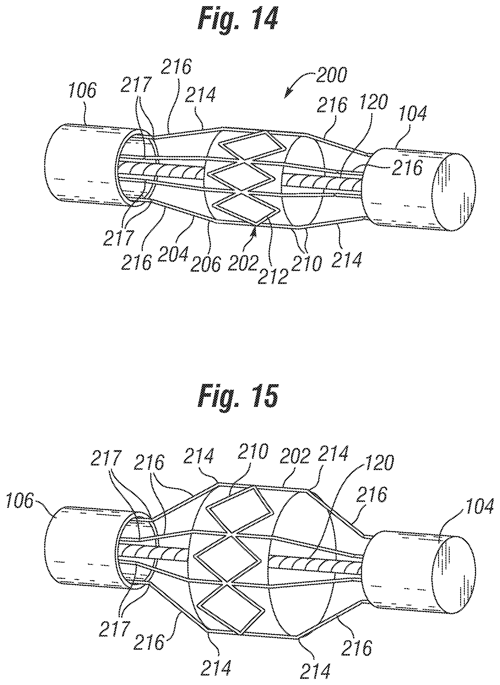 Patent US12310851 Figure 8 – Method for deploying a prosthetic heart valve