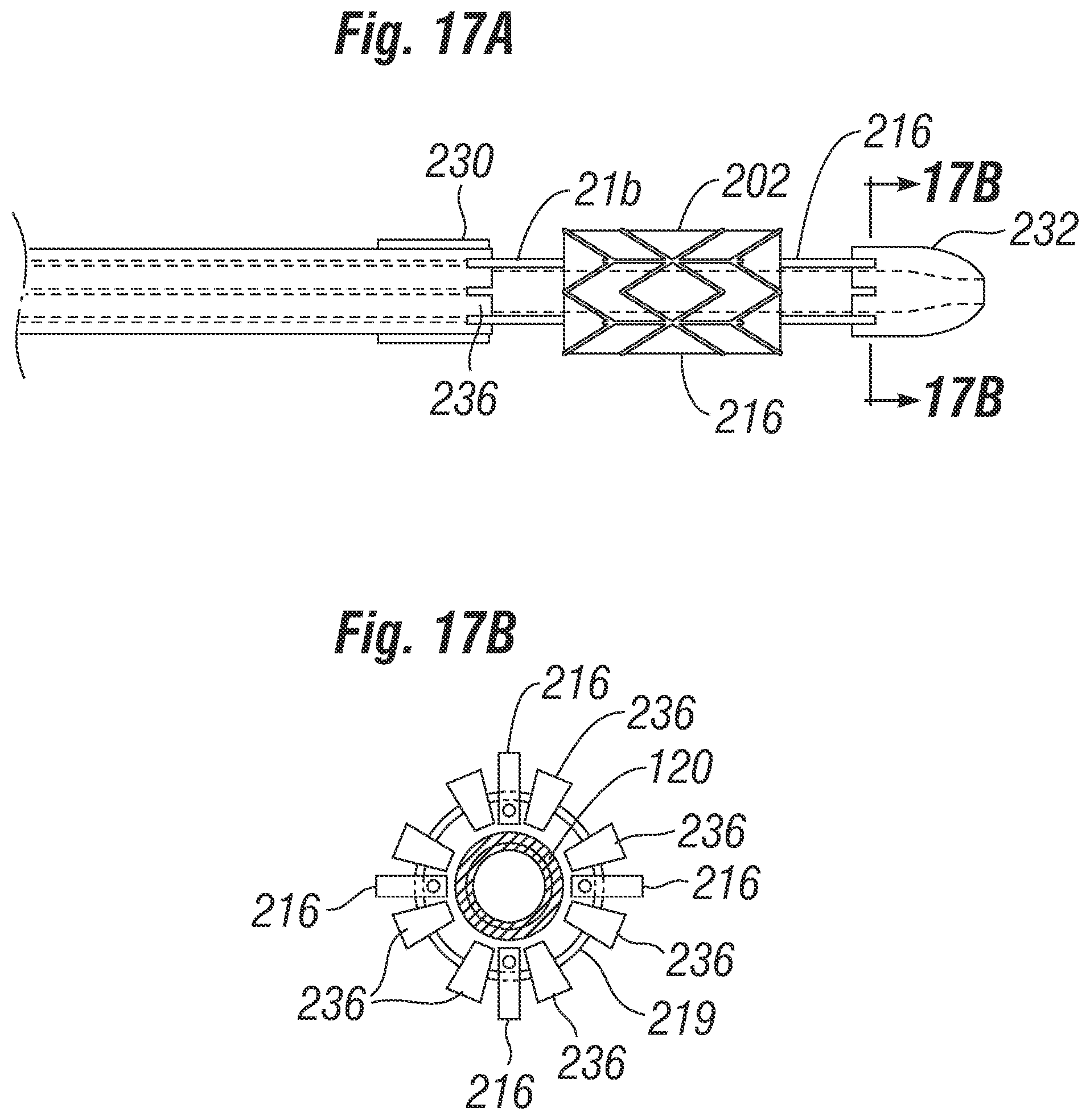 Patent US12310851 Figure 10 – Method for deploying a prosthetic heart valve