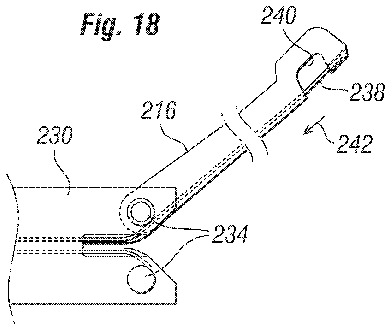 Patent US12310851 Figure 11 – Method for deploying a prosthetic heart valve