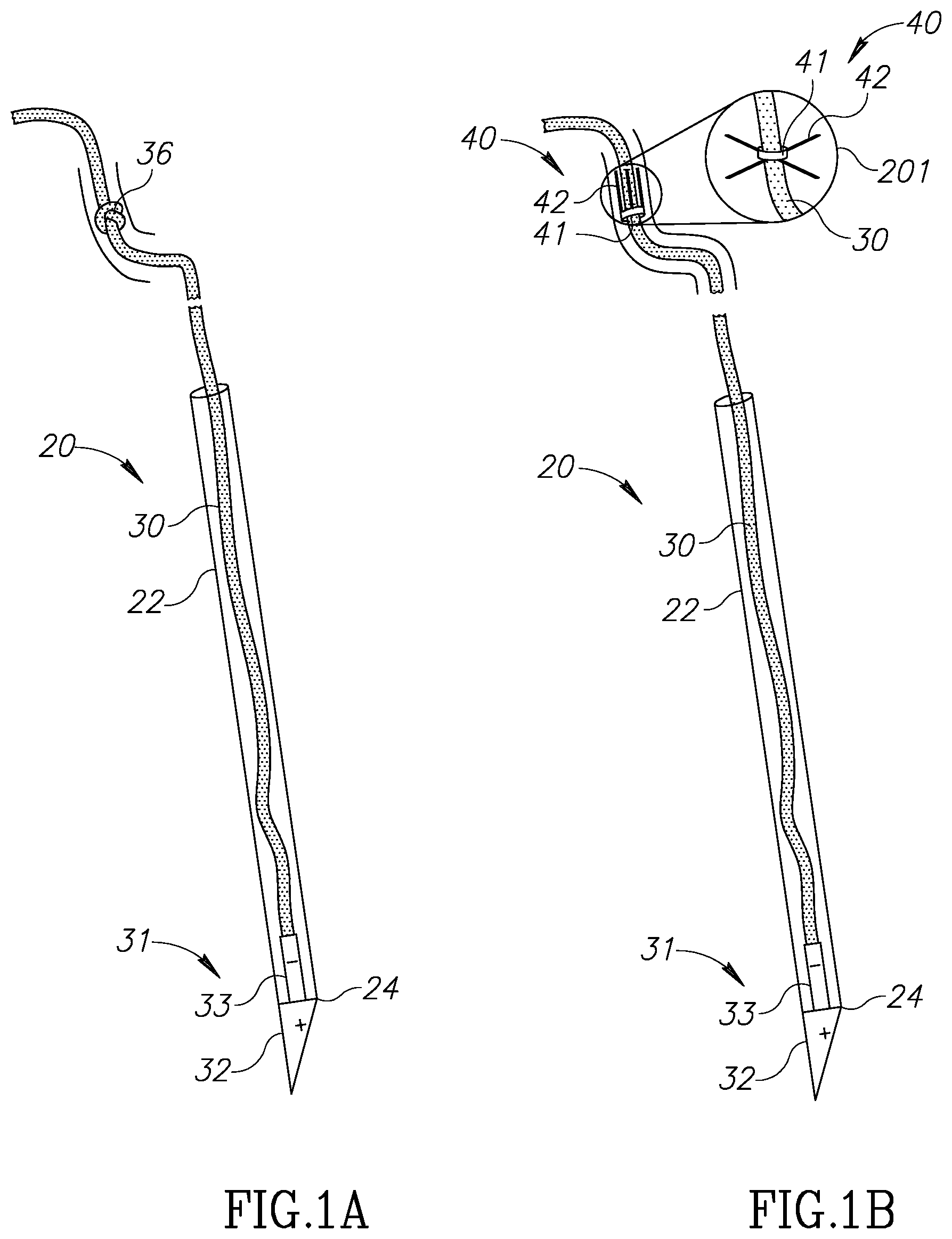 Patent US12310852 Figure 1 – Chorda replacement apparatus and method