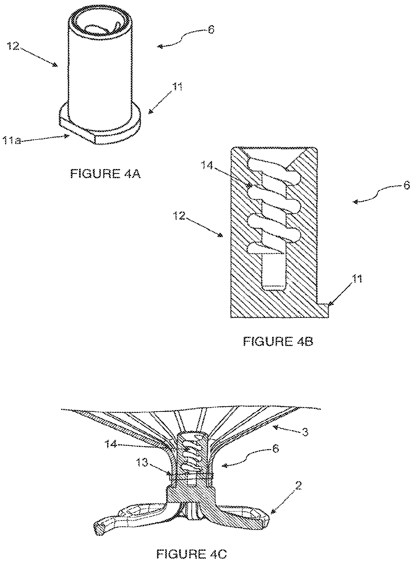 Patent US12310853 Figure 4 – Systems and methods for treating cardiac dysfunction