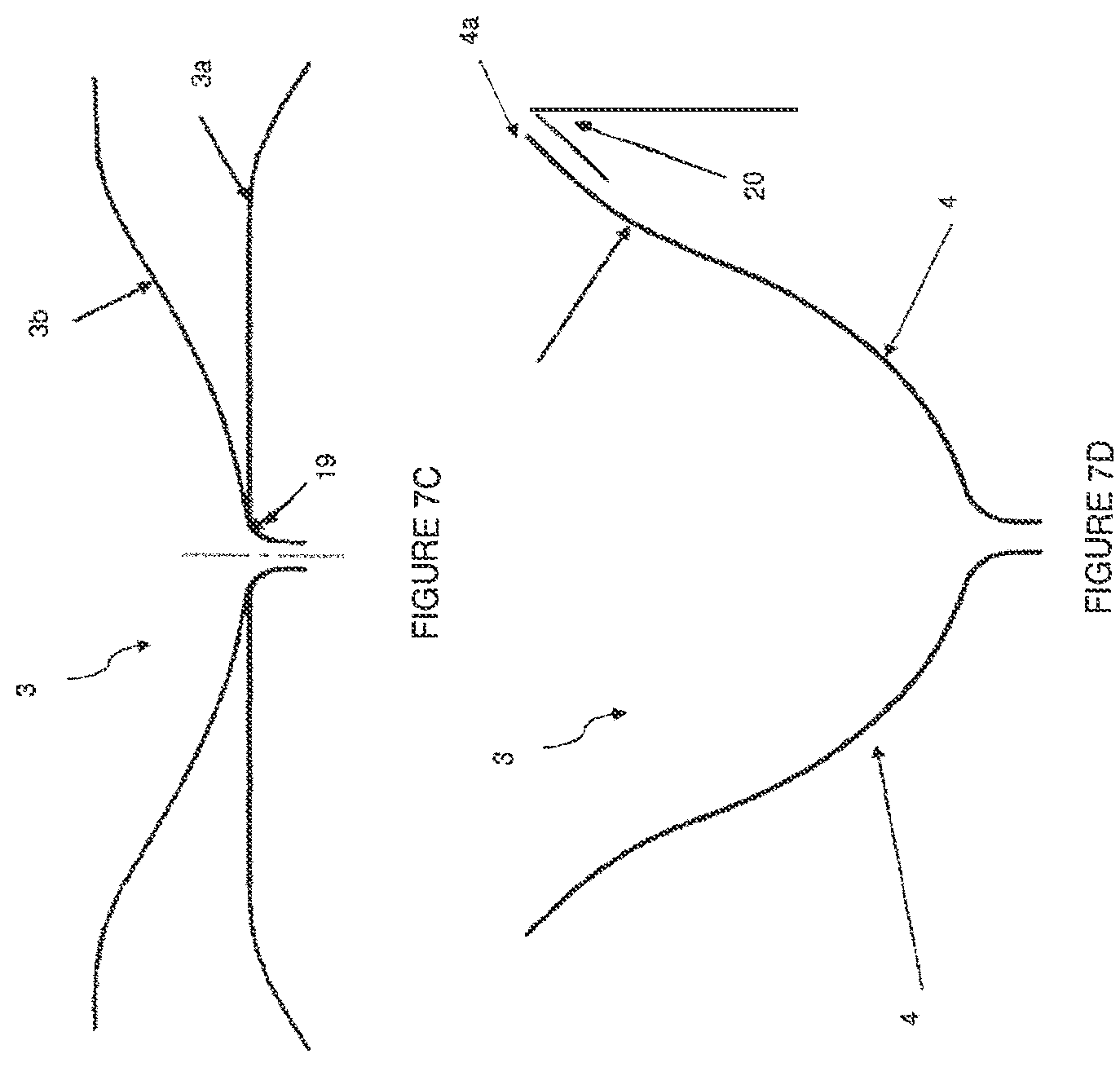 Patent US12310853 Figure 8 – Systems and methods for treating cardiac dysfunction