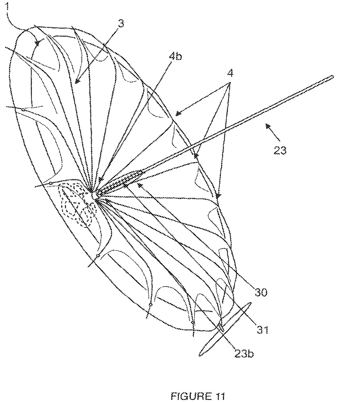 Patent US12310853 Figure 12 – Systems and methods for treating cardiac dysfunction