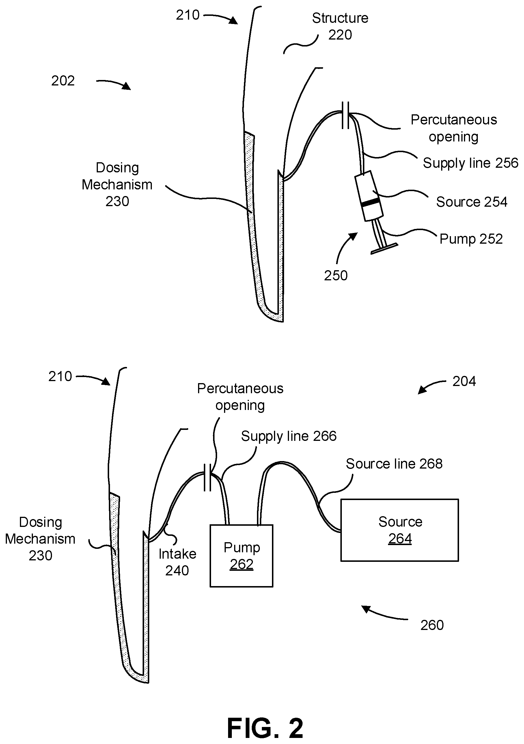 Patent US12310854 Figure 2 – Orthopaedic implant to administer a medical substance