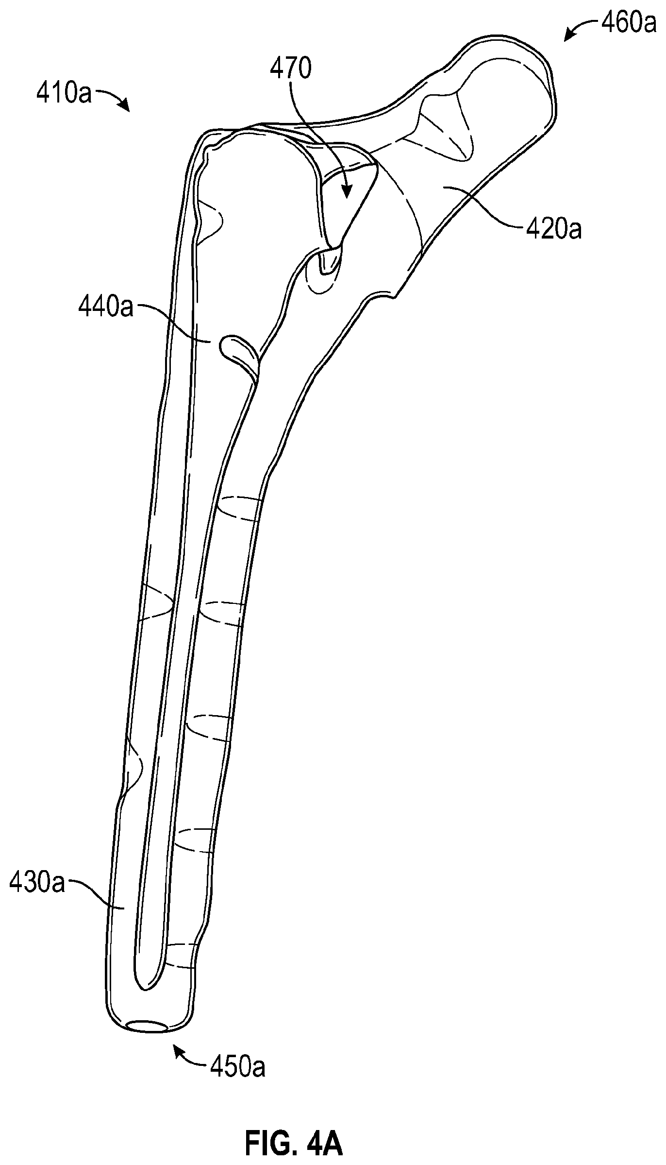 Patent US12310854 Figure 4 – Orthopaedic implant to administer a medical substance