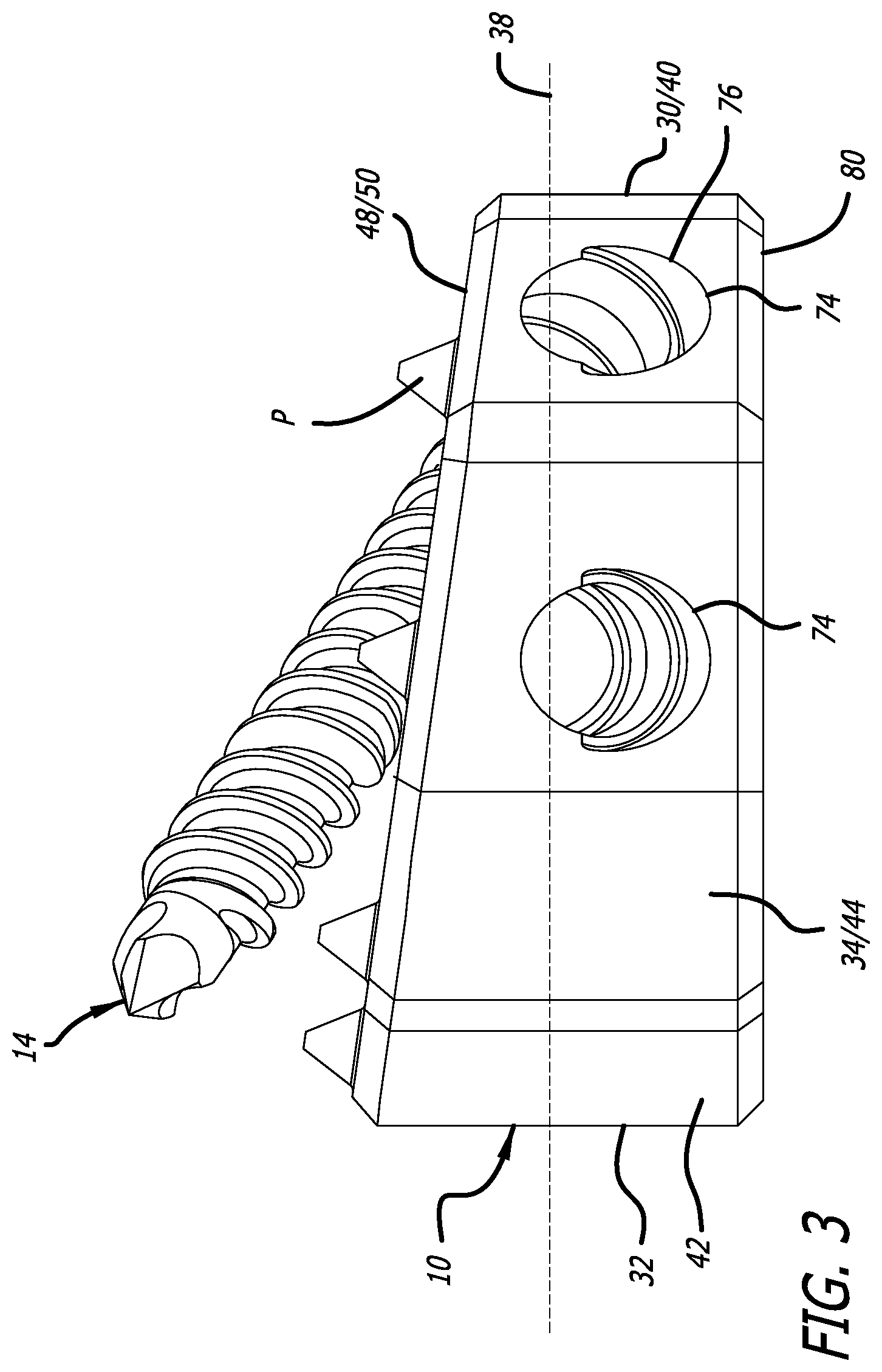Patent US12310855 Figure 3 – End cap and bone screw for use therewith
