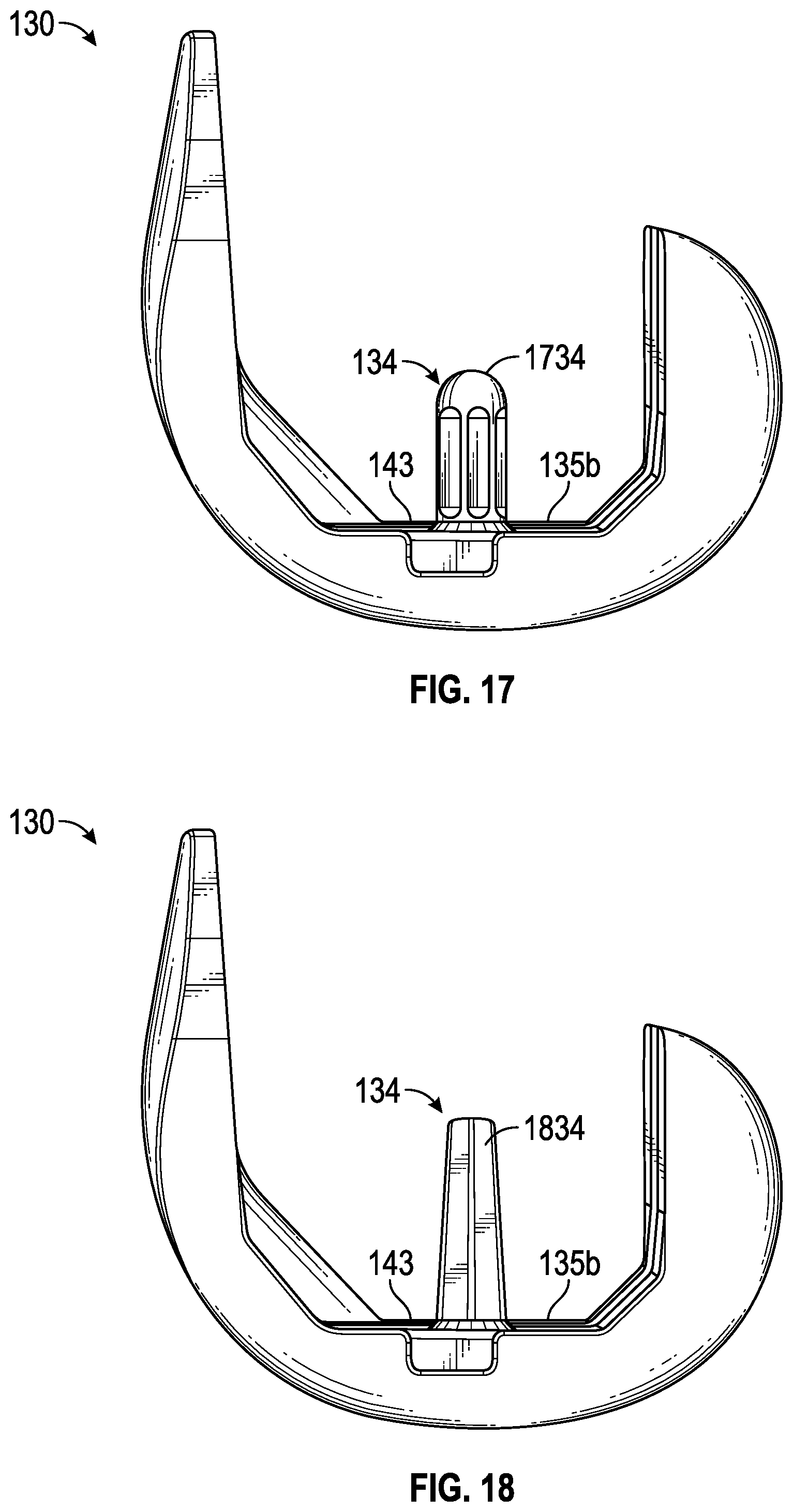 Patent US12310856 Figure 17 – Femoral component for bone conservation