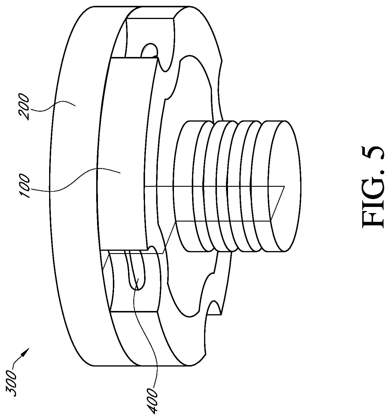 Patent US12310857 Figure 5 – Total shoulder prosthesis having inset glenoid implant convertible from anatomic to reverse