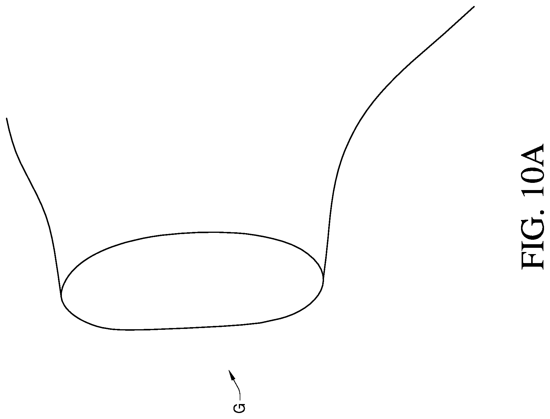 Patent US12310857 Figure 10 – Total shoulder prosthesis having inset glenoid implant convertible from anatomic to reverse