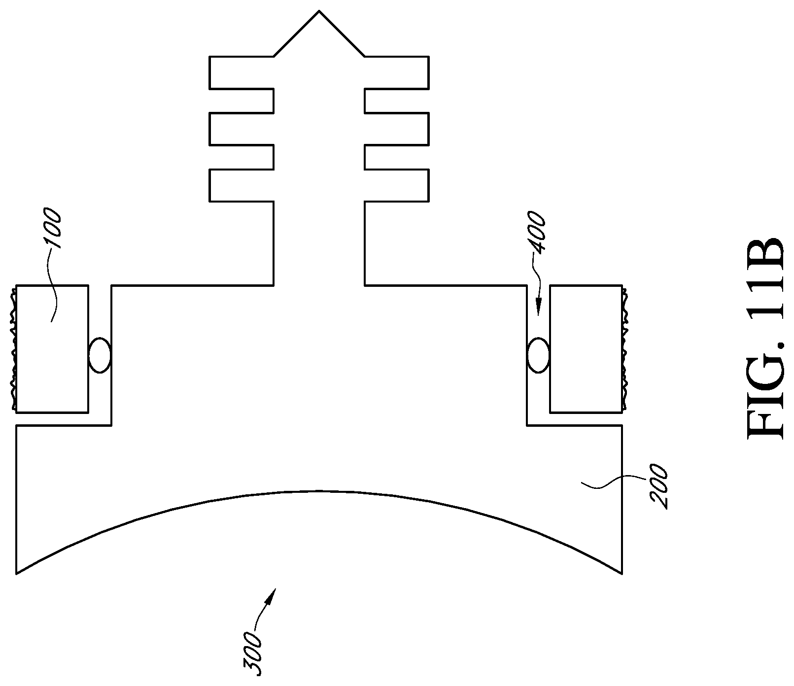 Patent US12310857 Figure 14 – Total shoulder prosthesis having inset glenoid implant convertible from anatomic to reverse