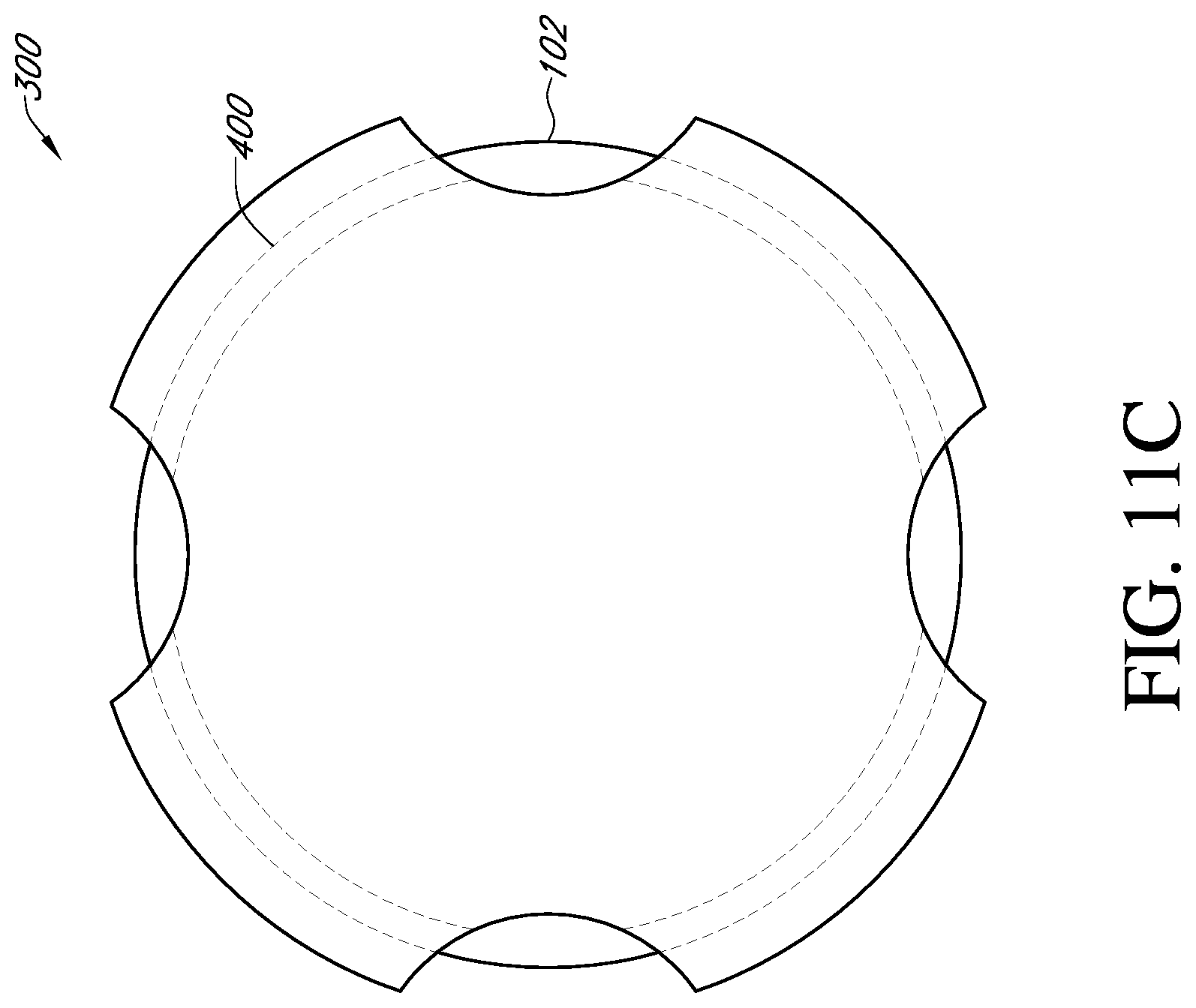 Patent US12310857 Figure 15 – Total shoulder prosthesis having inset glenoid implant convertible from anatomic to reverse