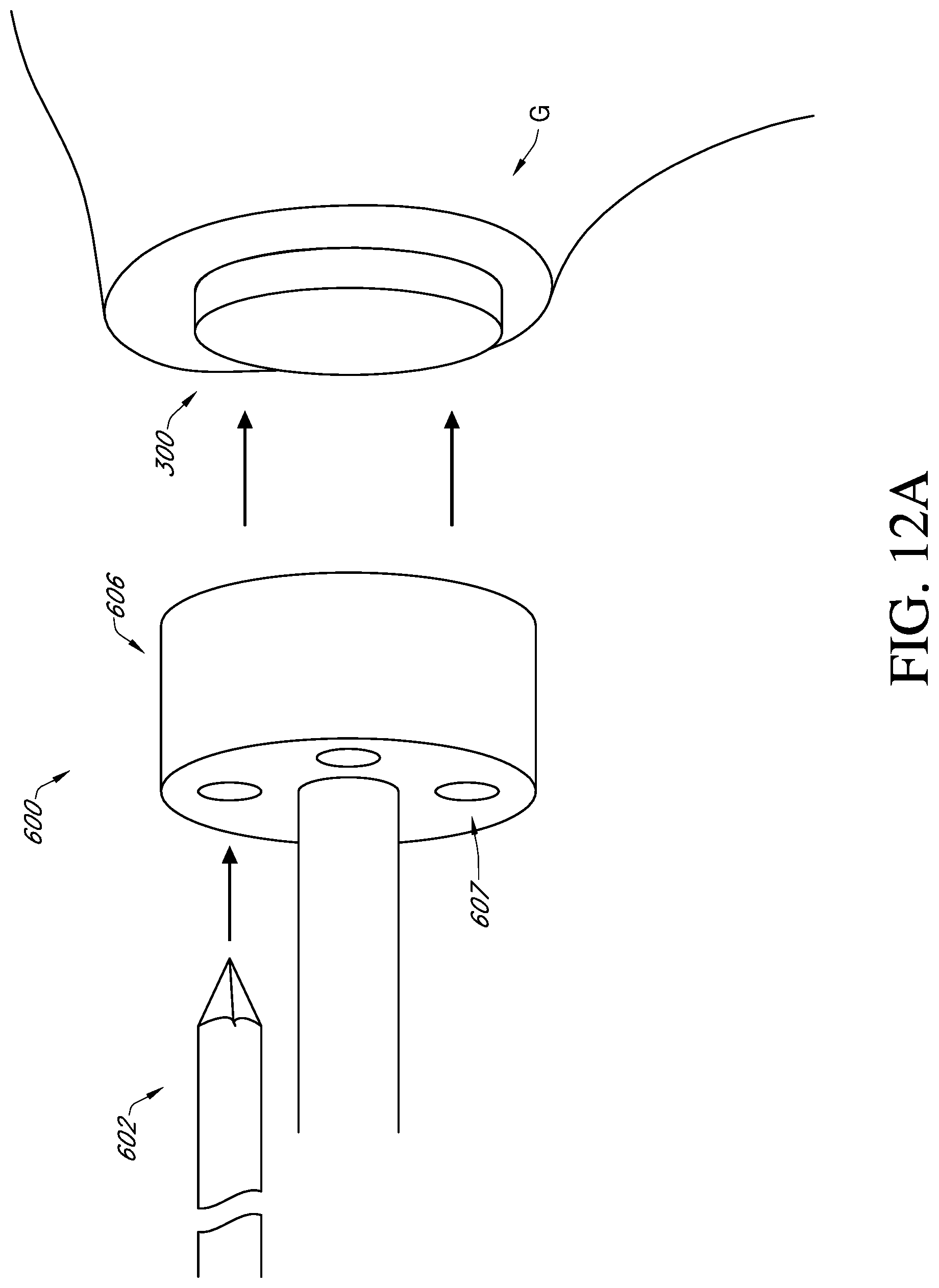 Patent US12310857 Figure 17 – Total shoulder prosthesis having inset glenoid implant convertible from anatomic to reverse