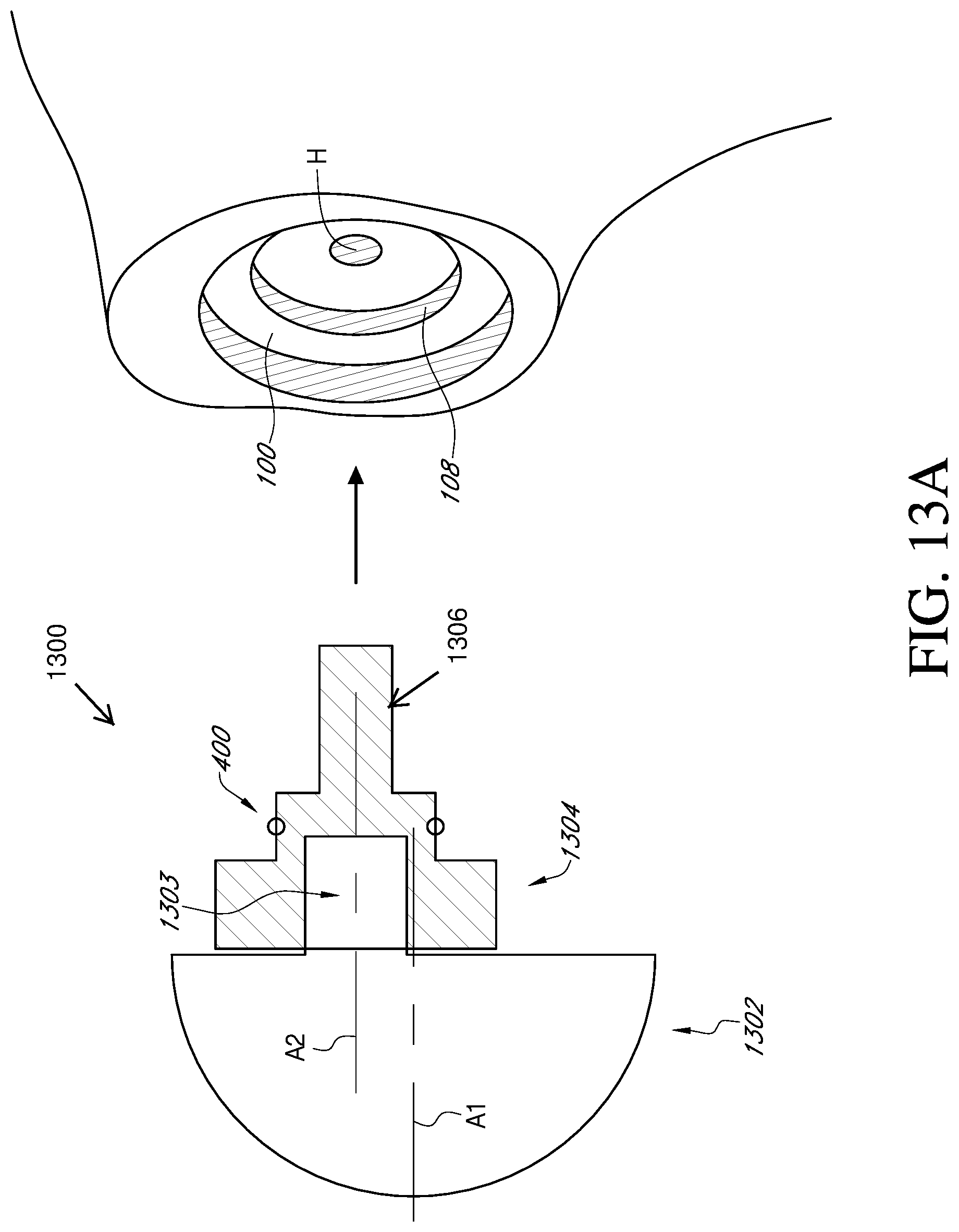 Patent US12310857 Figure 19 – Total shoulder prosthesis having inset glenoid implant convertible from anatomic to reverse