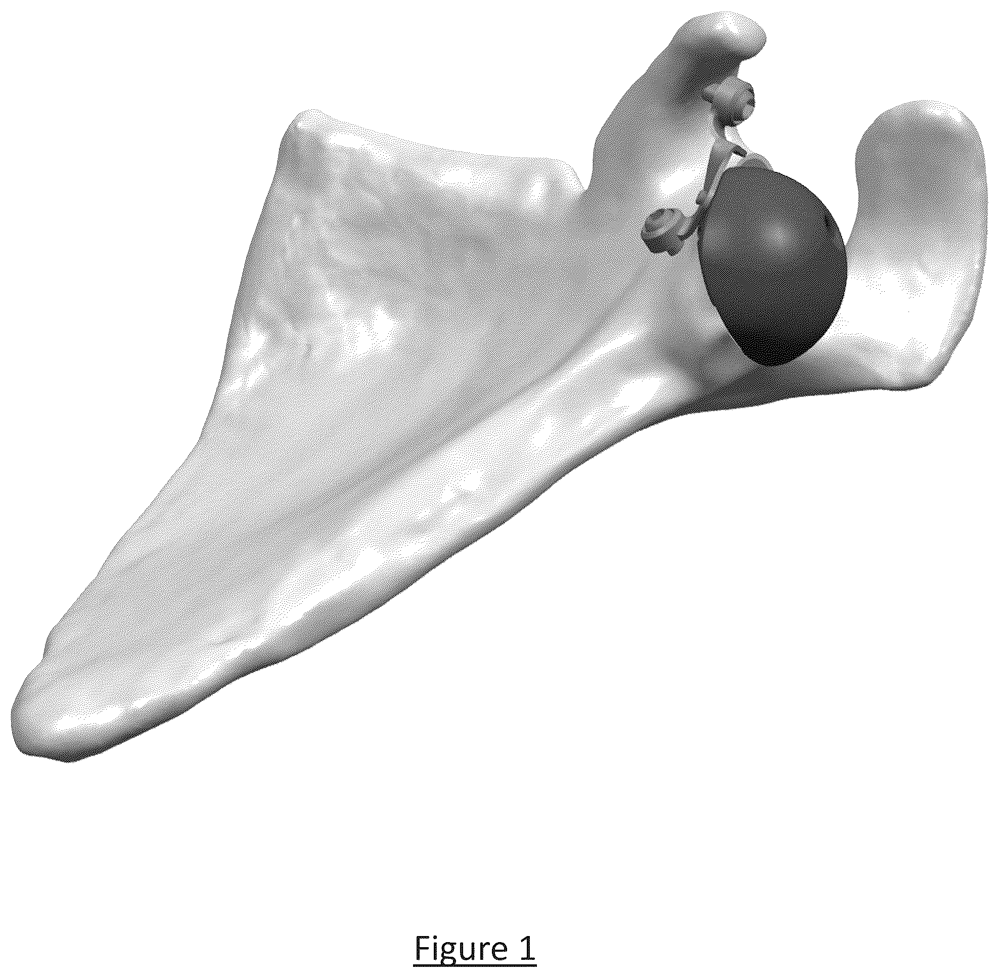 Patent US12310858 Figure 1 – Platform RTSA glenoid prosthesis with modular attachments capable of improving initial fixation, fracture reconstructions, and joint biomechanics