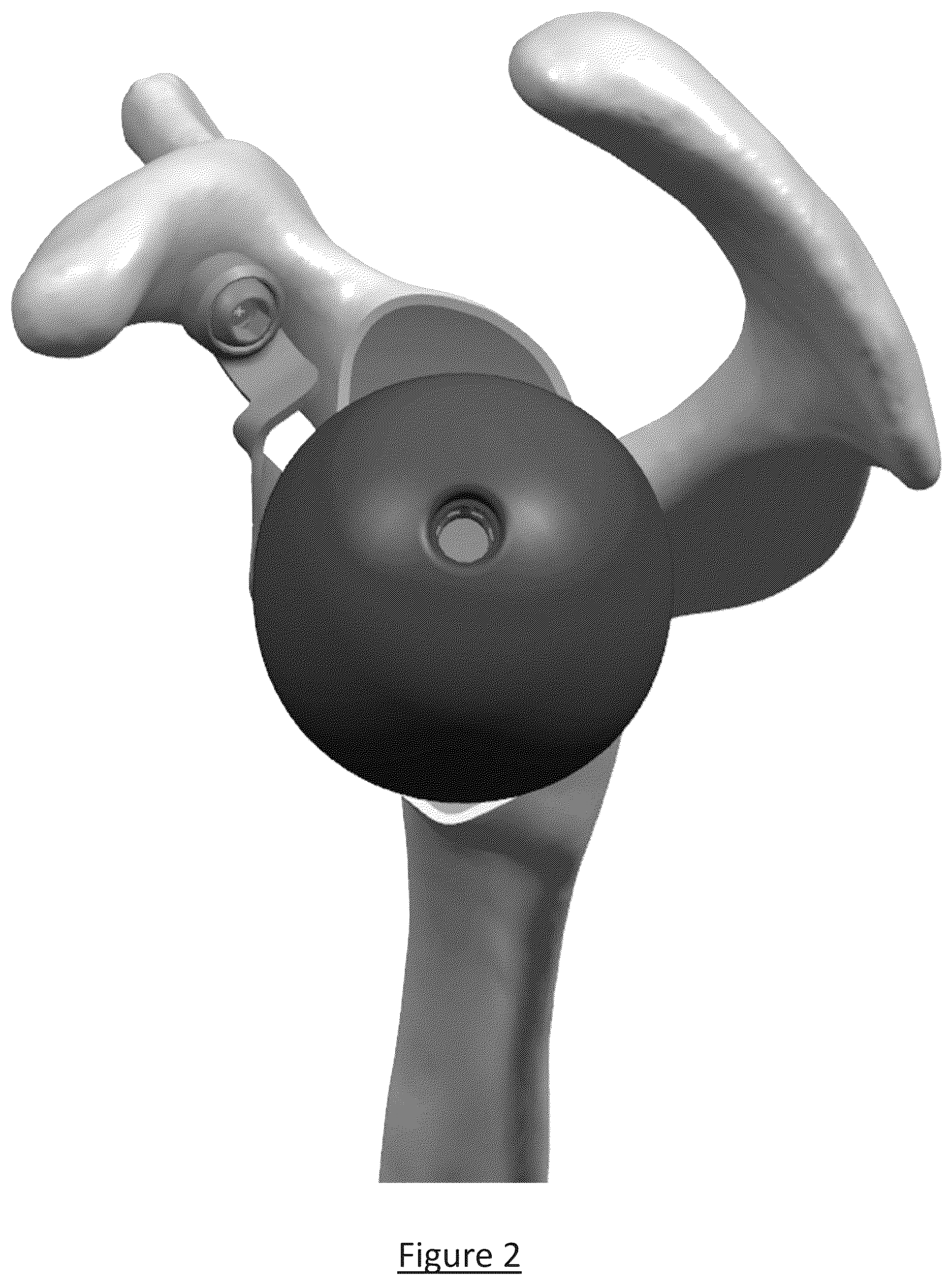 Patent US12310858 Figure 2 – Platform RTSA glenoid prosthesis with modular attachments capable of improving initial fixation, fracture reconstructions, and joint biomechanics