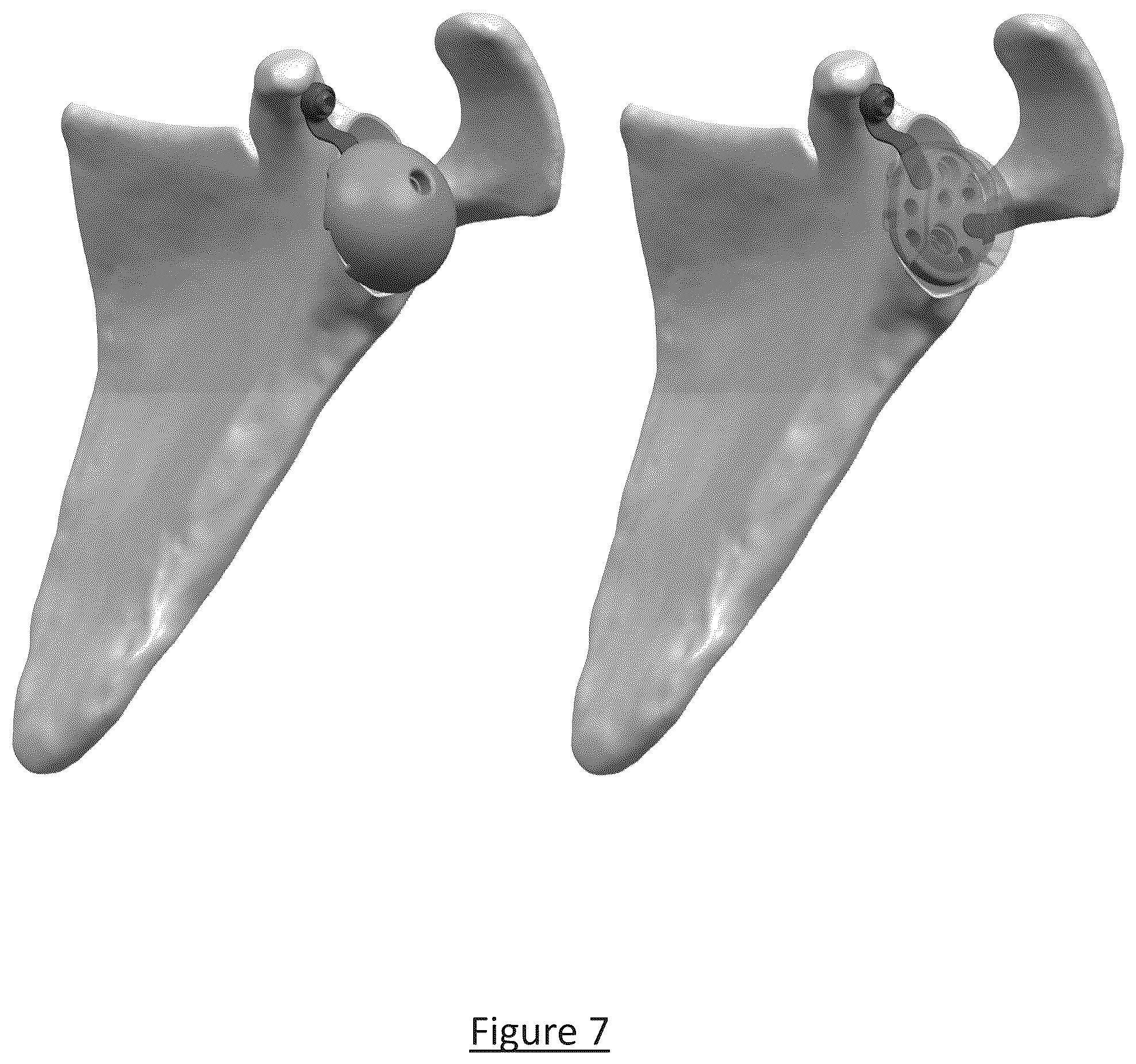 Patent US12310858 Figure 5 – Platform RTSA glenoid prosthesis with modular attachments capable of improving initial fixation, fracture reconstructions, and joint biomechanics