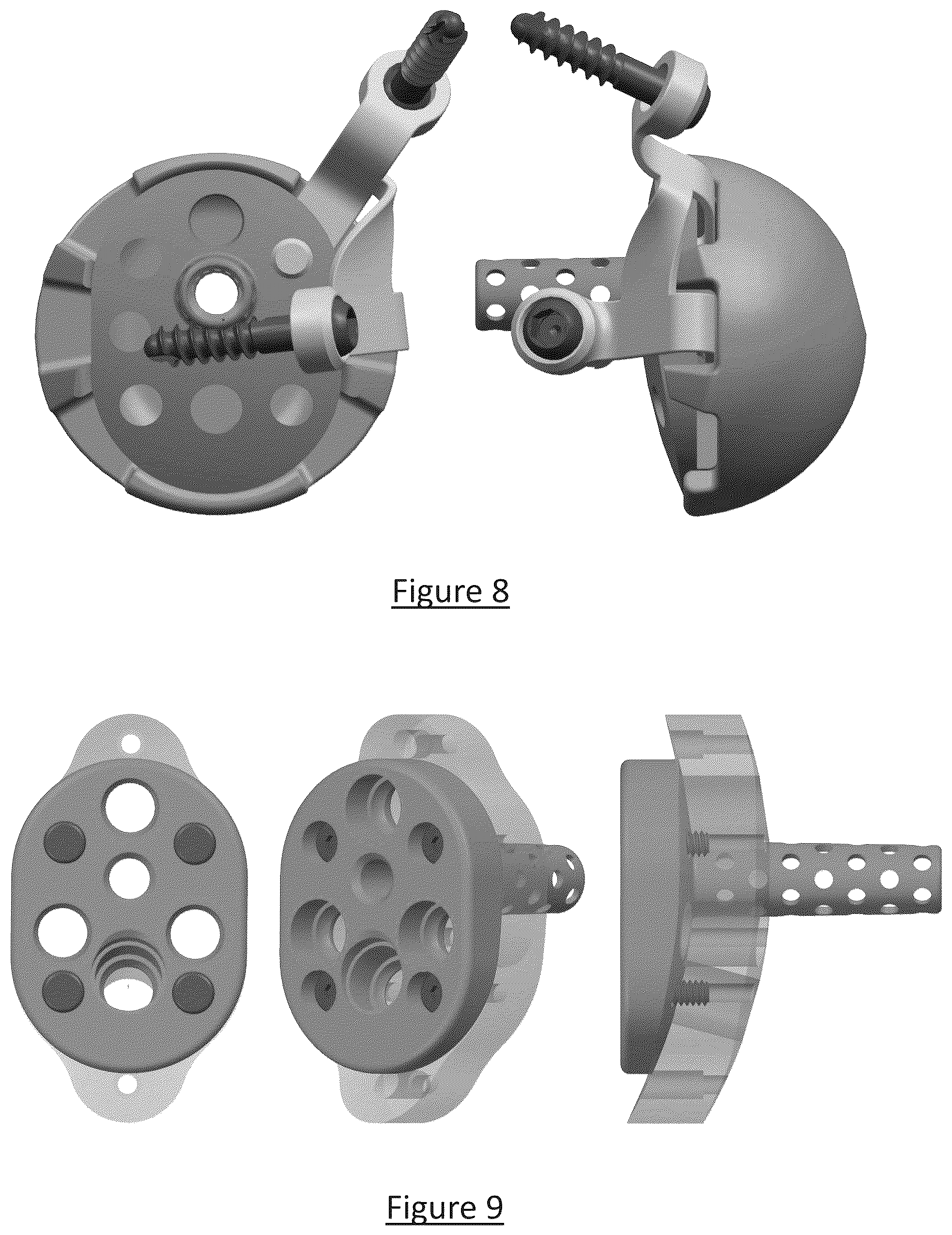 Patent US12310858 Figure 6 – Platform RTSA glenoid prosthesis with modular attachments capable of improving initial fixation, fracture reconstructions, and joint biomechanics