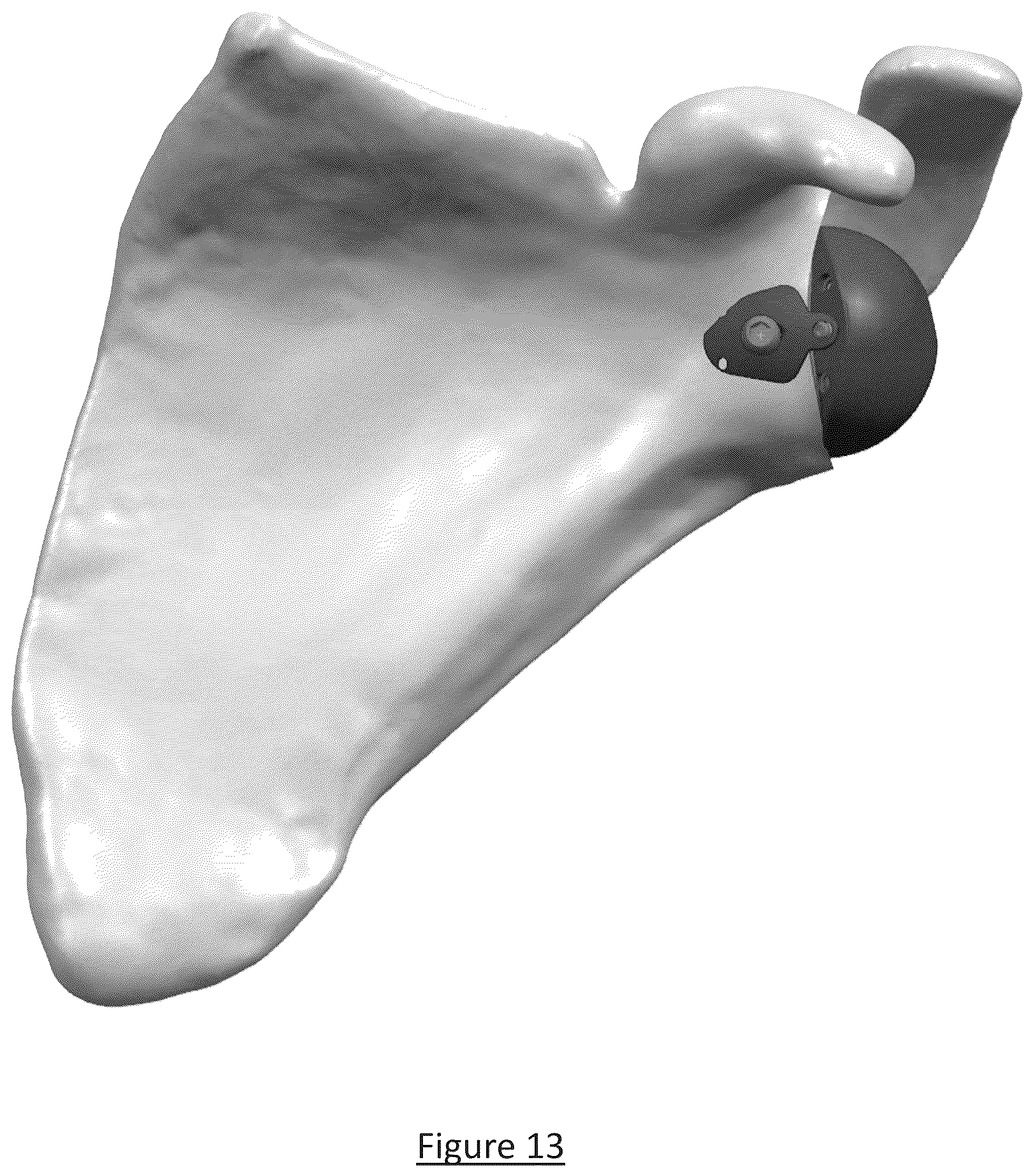 Patent US12310858 Figure 10 – Platform RTSA glenoid prosthesis with modular attachments capable of improving initial fixation, fracture reconstructions, and joint biomechanics