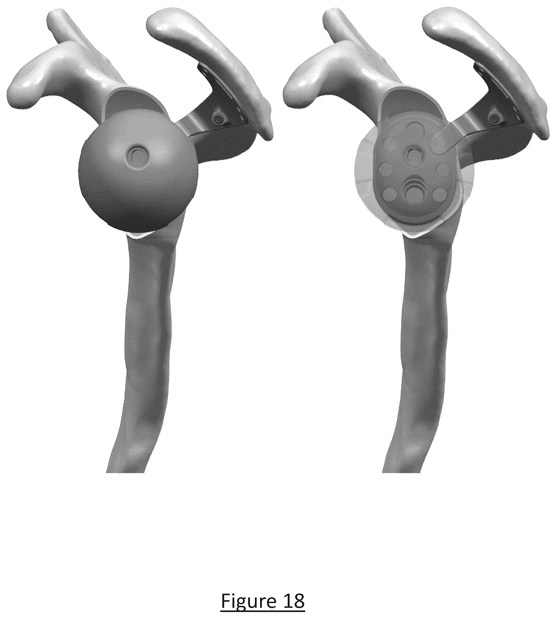 Patent US12310858 Figure 13 – Platform RTSA glenoid prosthesis with modular attachments capable of improving initial fixation, fracture reconstructions, and joint biomechanics