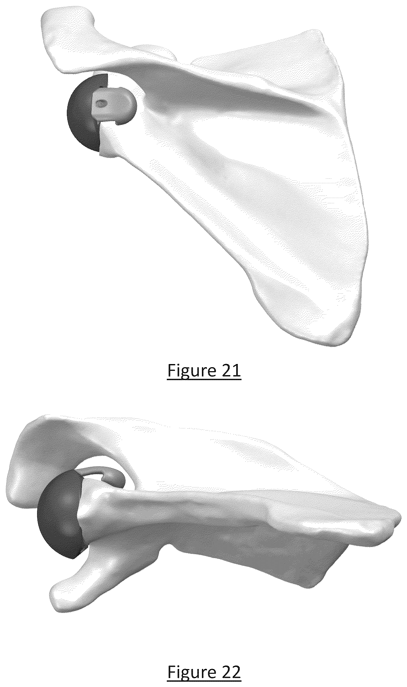 Patent US12310858 Figure 16 – Platform RTSA glenoid prosthesis with modular attachments capable of improving initial fixation, fracture reconstructions, and joint biomechanics